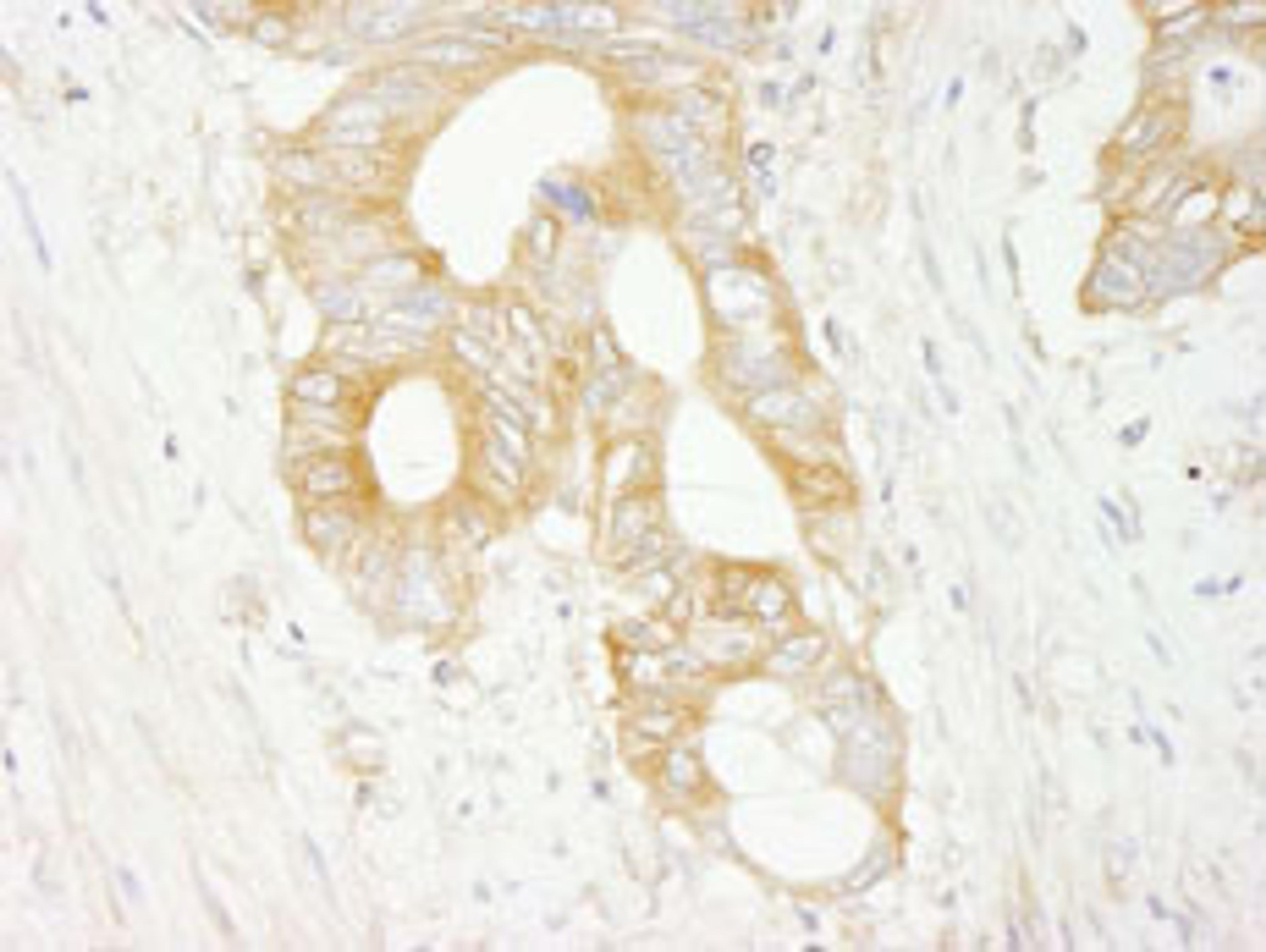 Detection of human eIF3J/EIF3S1 by immunohistochemistry.