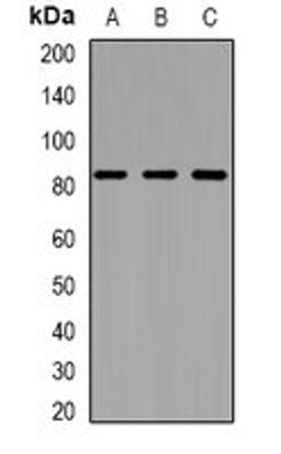 Western blot analysis of MCF7 (Lane1), RAW264.7 (Lane2), H9C2 (Lane3) whole cell lysates using ZNF600 antibody