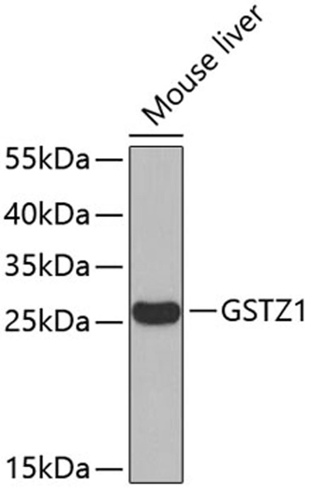 Western blot - GSTZ1 antibody (A6129)