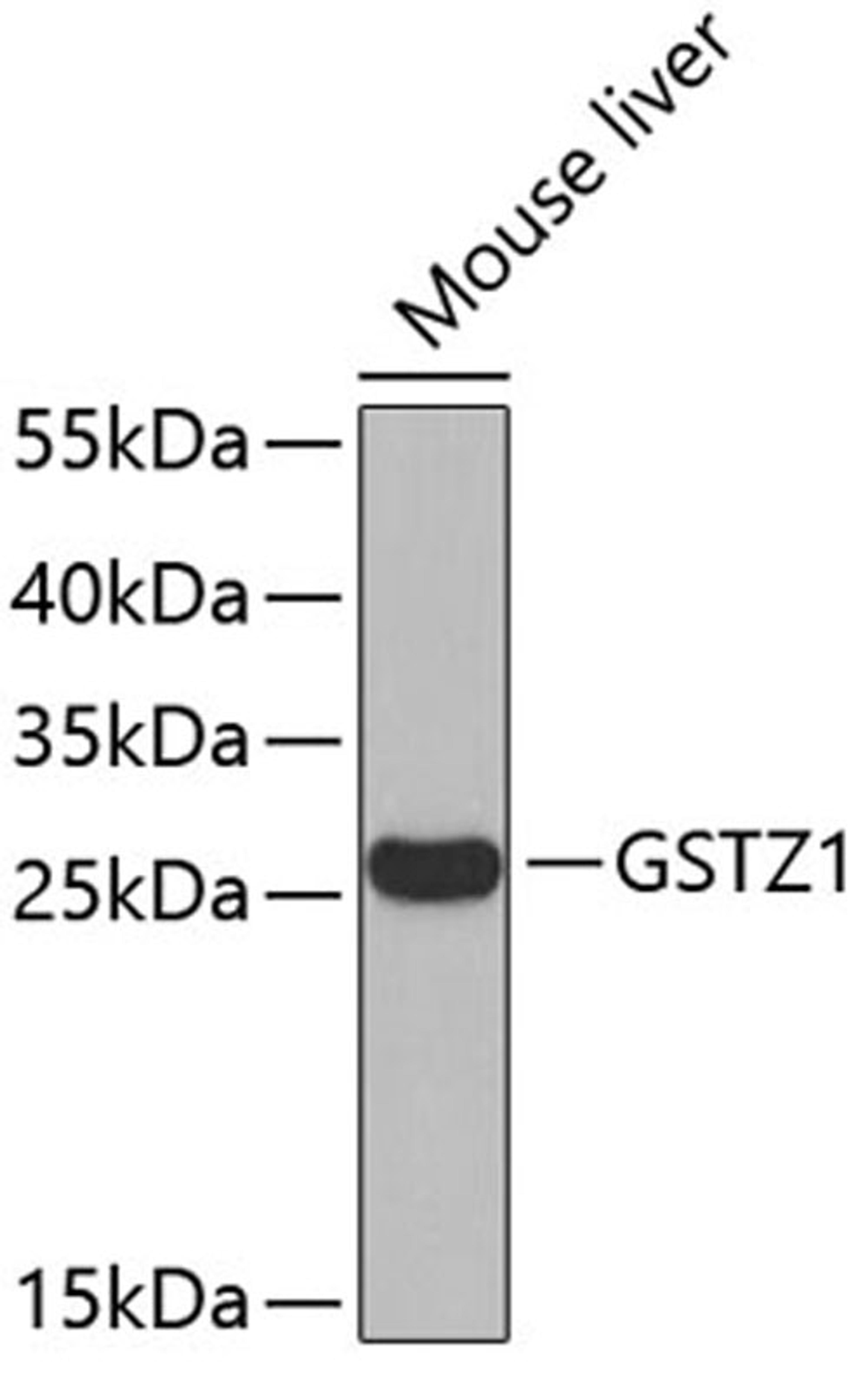 Western blot - GSTZ1 antibody (A6129)