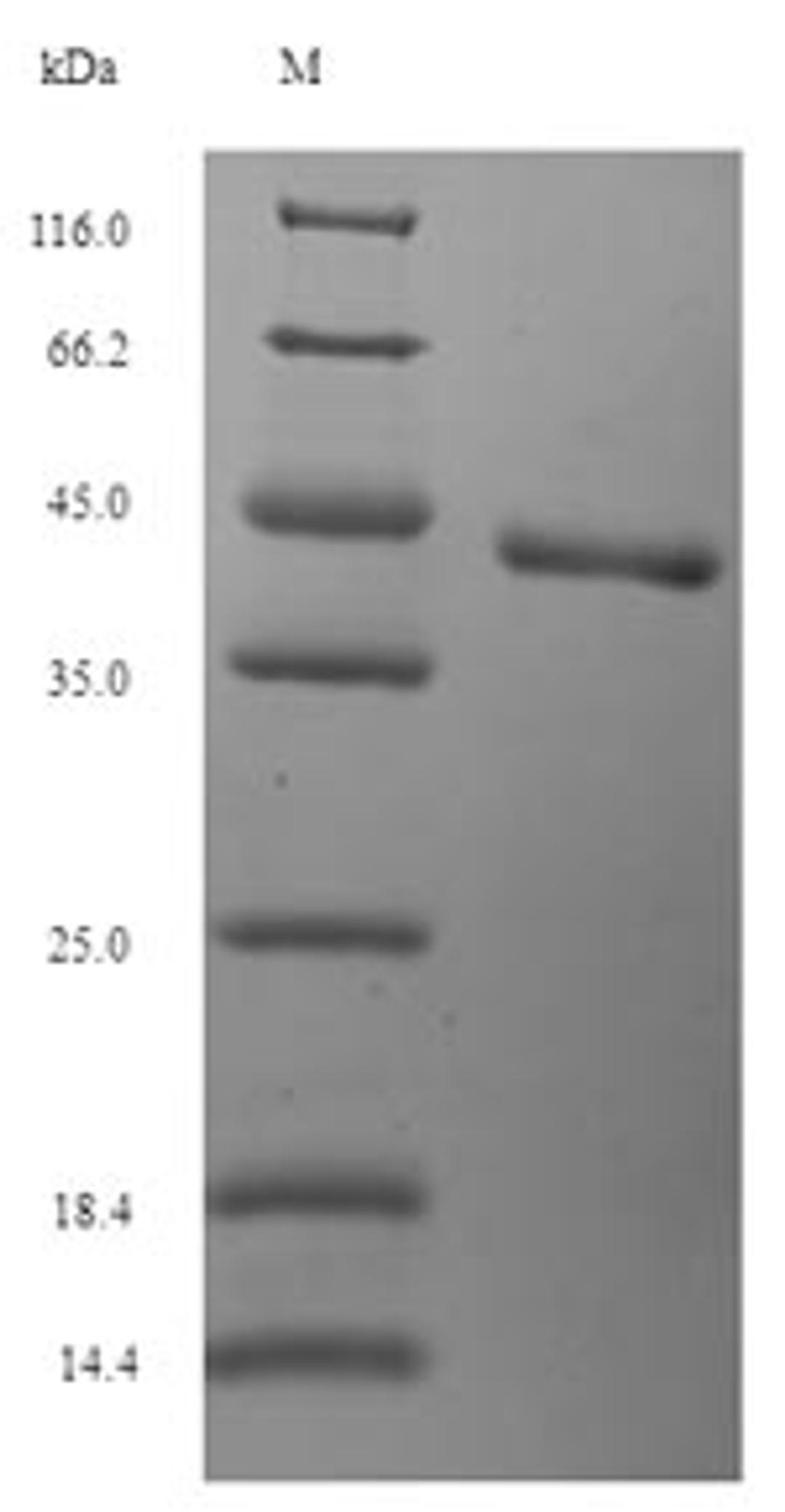 (Tris-Glycine gel) Discontinuous SDS-PAGE (reduced) with 5% enrichment gel and 15% separation gel.