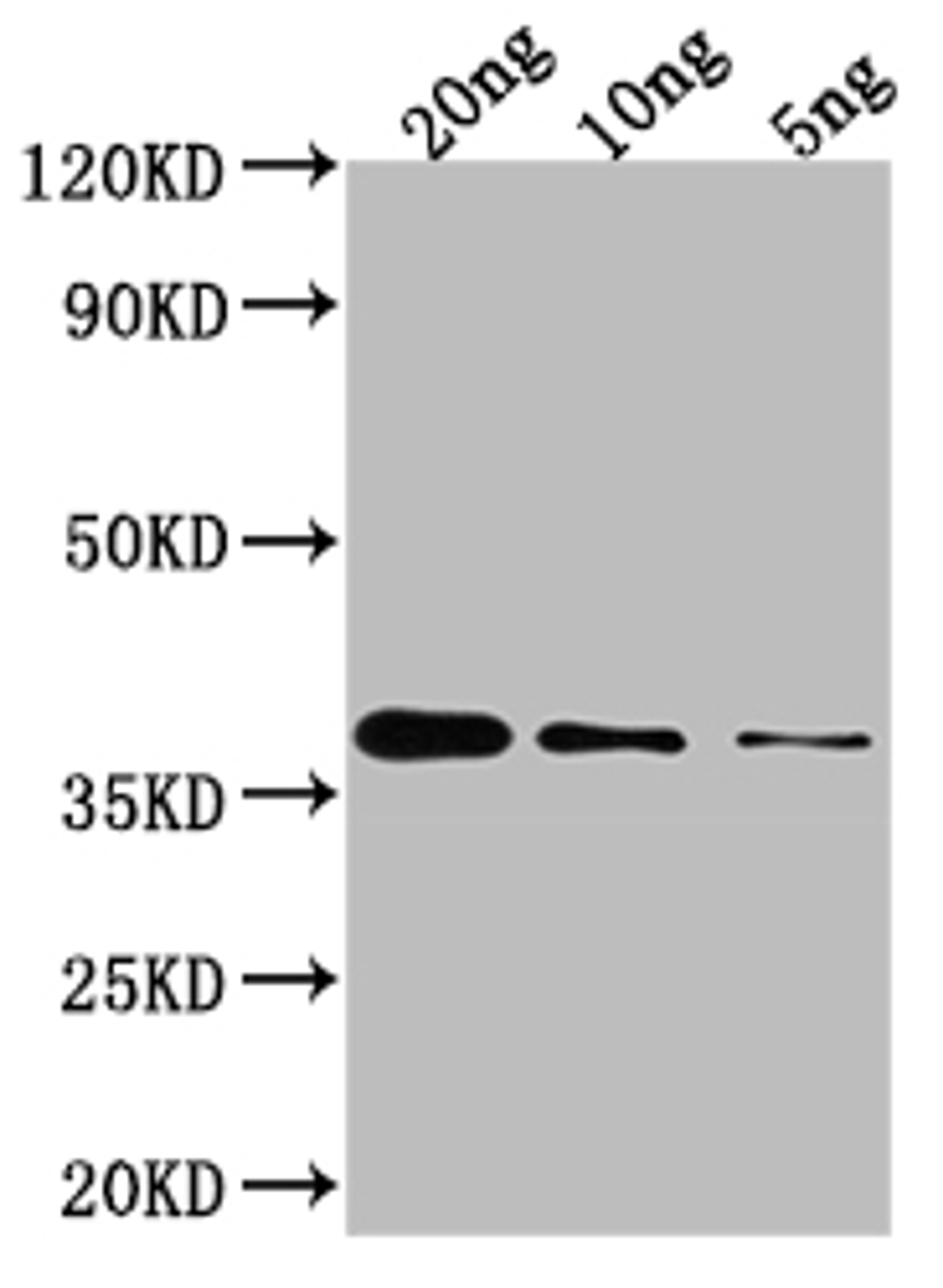 Western Blot. Positive WB detected in Recombinant protein. All lanes: GLMU antibody at 1:2000. Secondary. Goat polyclonal to rabbit IgG at 1/50000 dilution. Predicted band size: 37.7 kDa. Observed band size: 35 kDa.