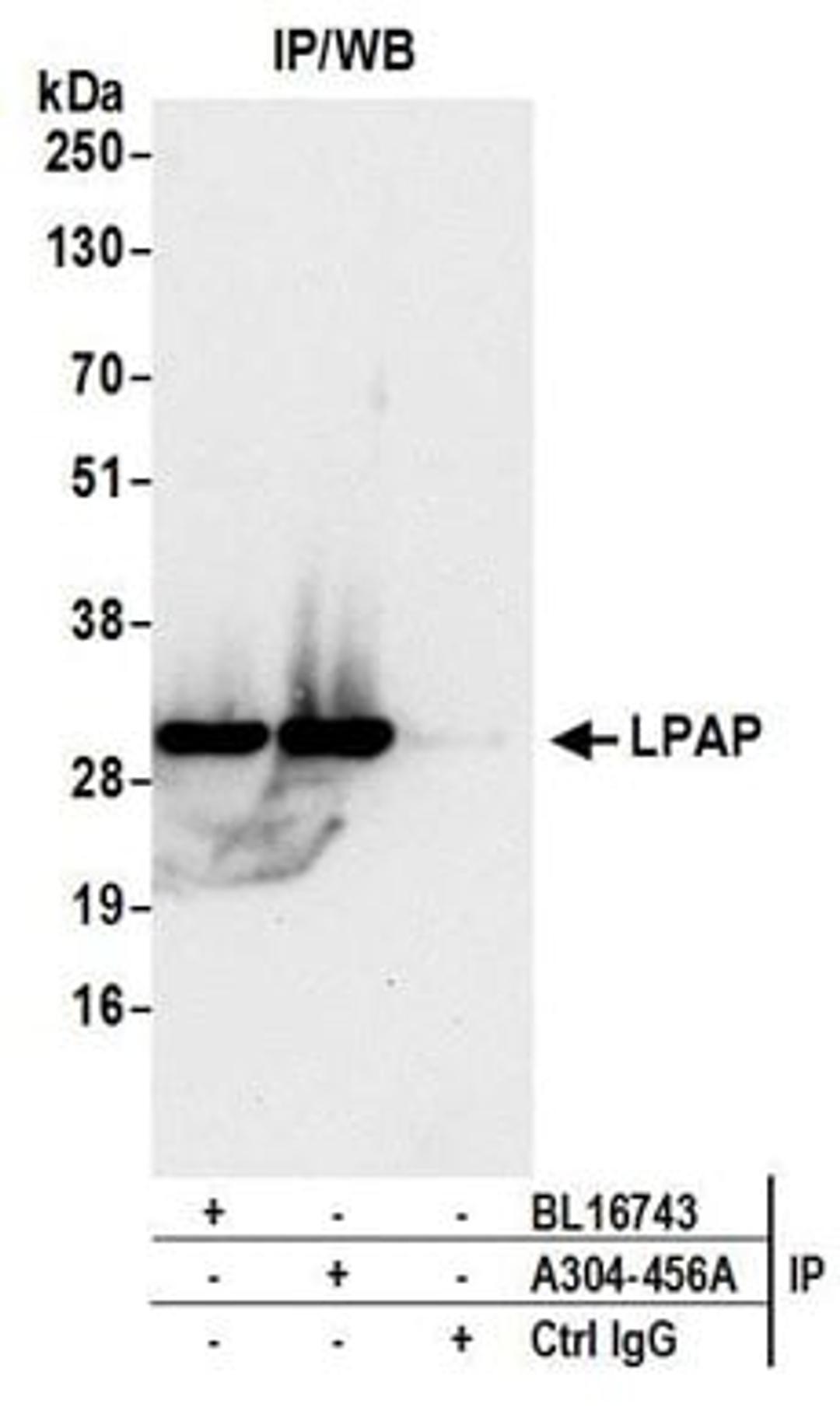 Detection of human LPAP by western blot of immunoprecipitates.