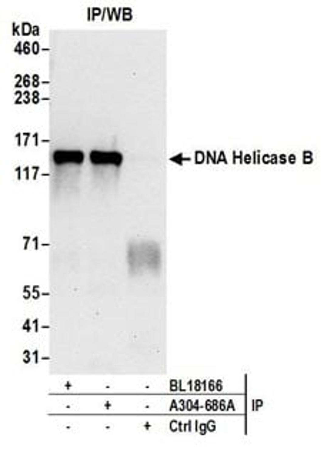 Detection of human DNA Helicase B by western blot of immunoprecipitates.