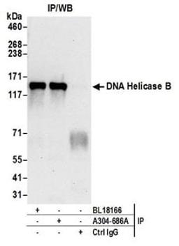 Detection of human DNA Helicase B by western blot of immunoprecipitates.