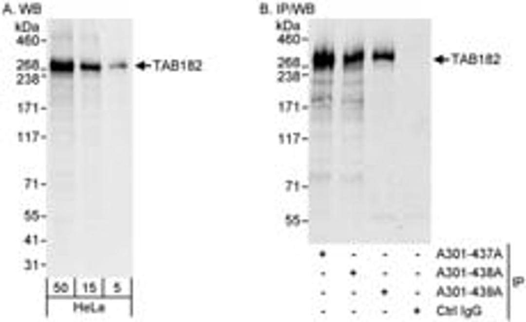 Detection of human TAB182 by western blot and immunoprecipitation.