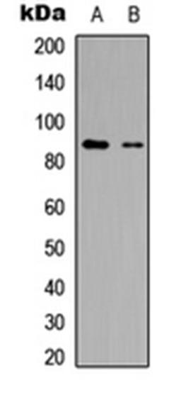 Western blot analysis of HepG2 (Lane 1), Jurkat (Lane 2) whole cell lysates using R3HCC1L antibody