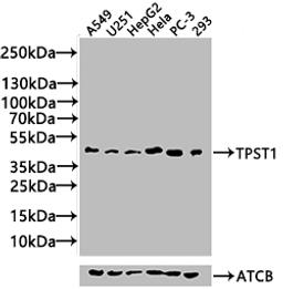 Western Blot. Positive WB detected in: Rat liver tissue, Mouse liver tissue, Mouse kidney tissue. All lanes: TPST1 antibody at 2.4ug/ml. Secondary. Goat polyclonal to rabbit IgG at 1/50000 dilution. Predicted band size: 43 kDa. Observed band size: 50 kDa. 