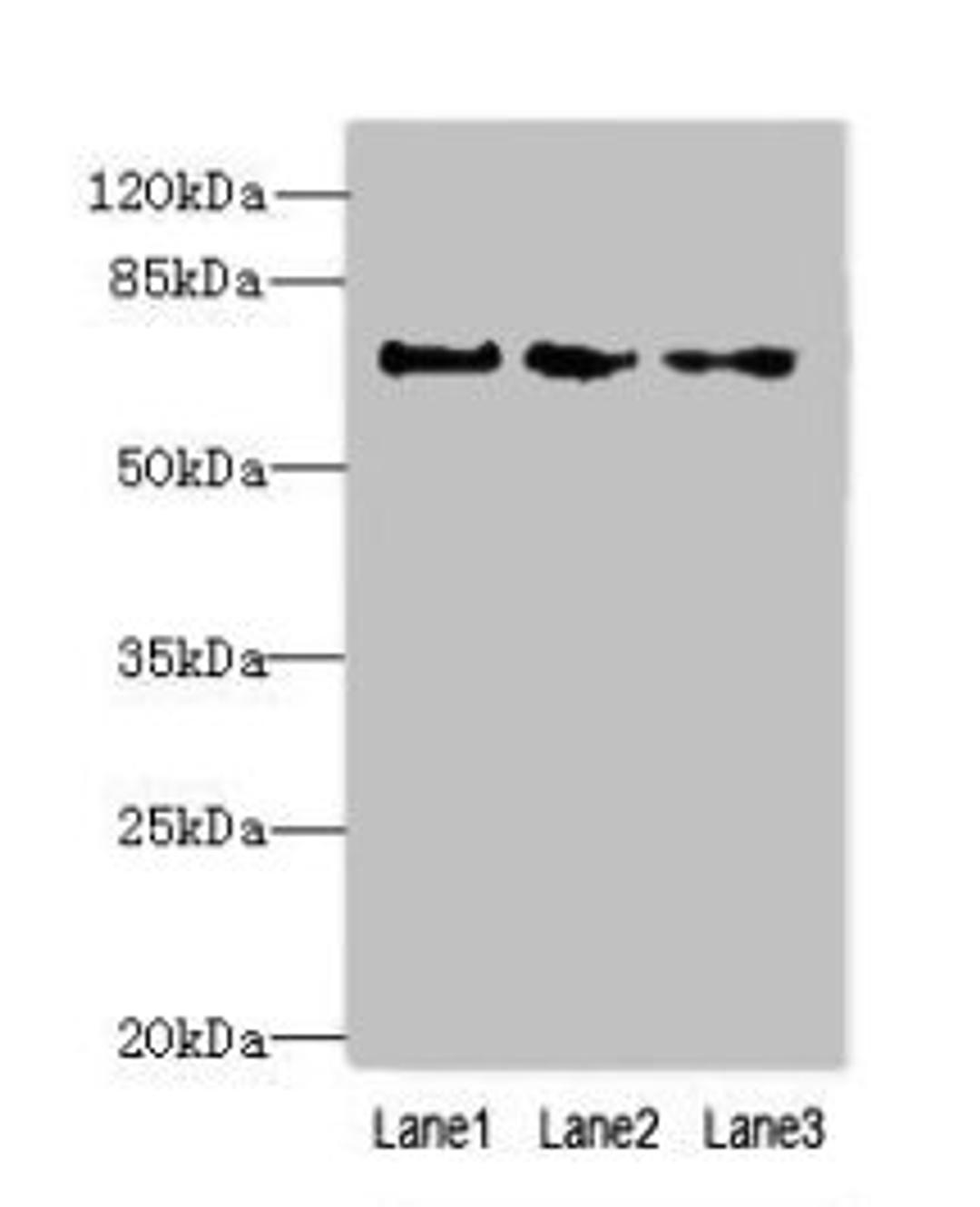 Western blot. All lanes: PPIL4 antibody at 4µg/ml. Lane 1: Hela whole cell lysate. Lane 2: Mouse kidney tissue. Lane 3: HepG2 whole cell lysate. Secondary. Goat polyclonal to rabbit IgG at 1/10000 dilution. Predicted band size: 58 kDa. Observed band size: 70 kDa