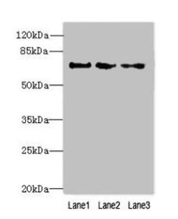 Western blot. All lanes: PPIL4 antibody at 4µg/ml. Lane 1: Hela whole cell lysate. Lane 2: Mouse kidney tissue. Lane 3: HepG2 whole cell lysate. Secondary. Goat polyclonal to rabbit IgG at 1/10000 dilution. Predicted band size: 58 kDa. Observed band size: 70 kDa
