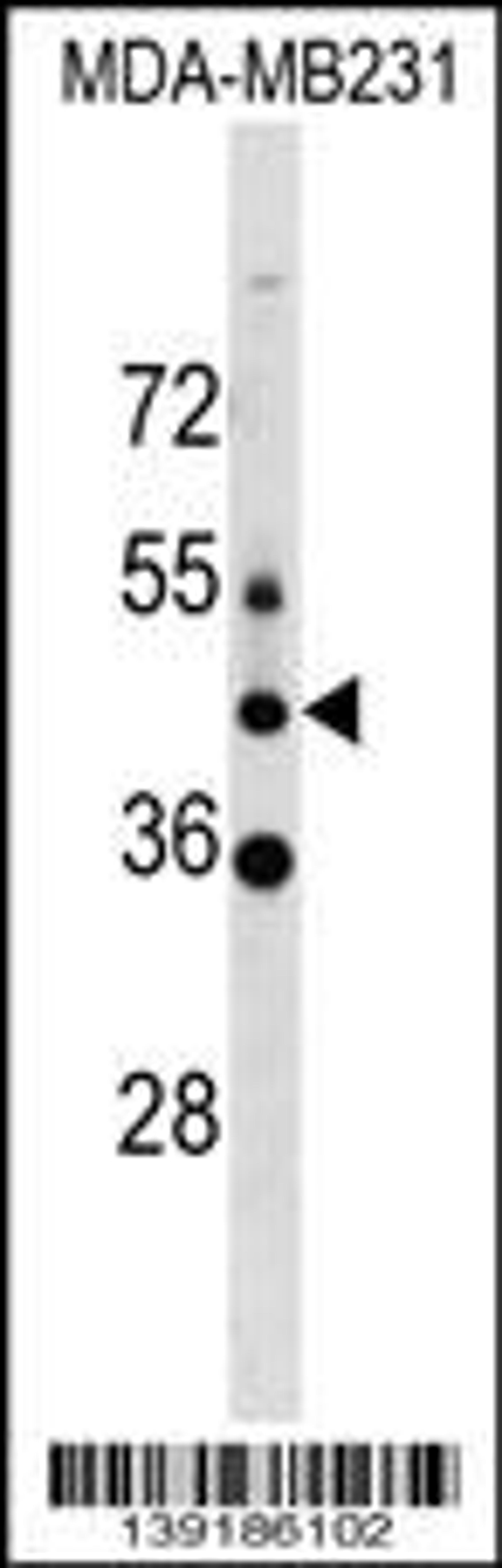 Western blot analysis in MDA-MB231 cell line lysates (35ug/lane).