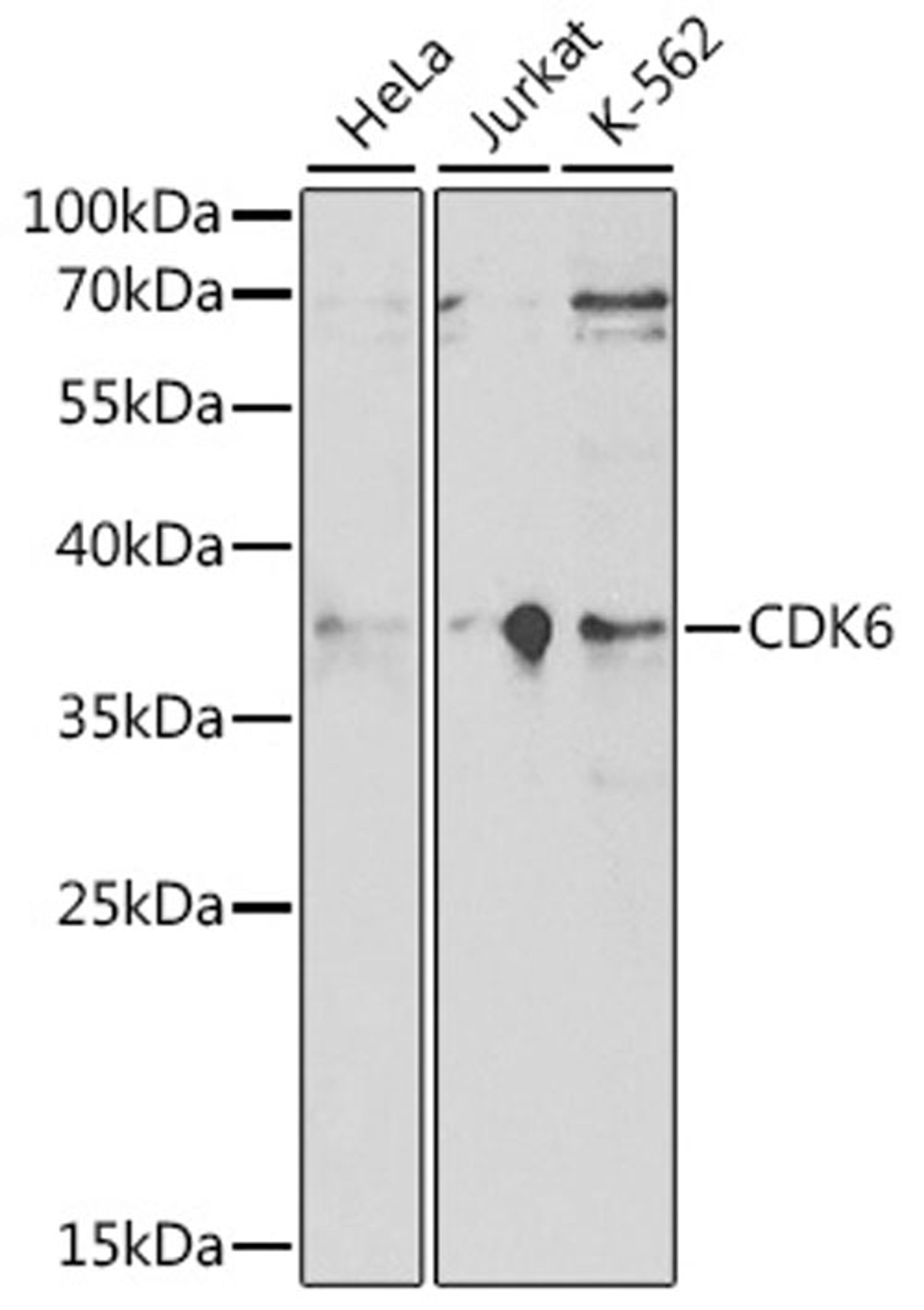 Western blot - CDK6 antibody (A16357)