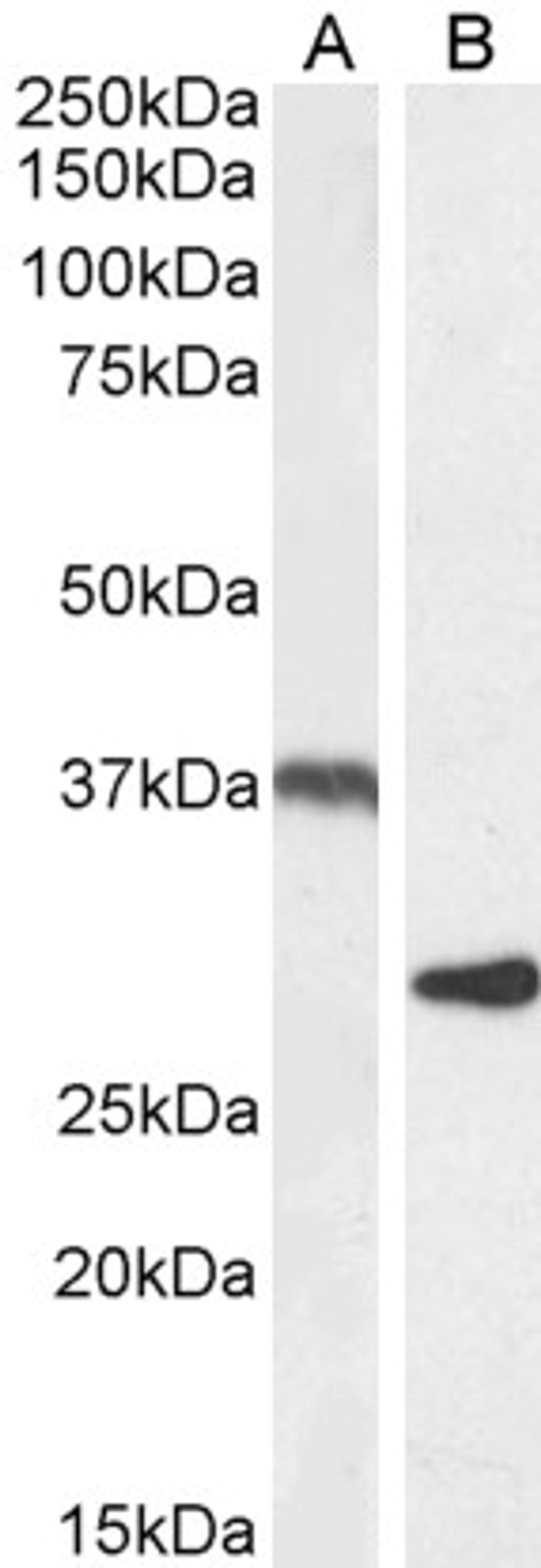 46-549 (1ug/ml) staining of Rat Adipose (A) and Mouse Spleen (B) lysate (35ug protein in RIPA buffer). Detected by chemiluminescence.