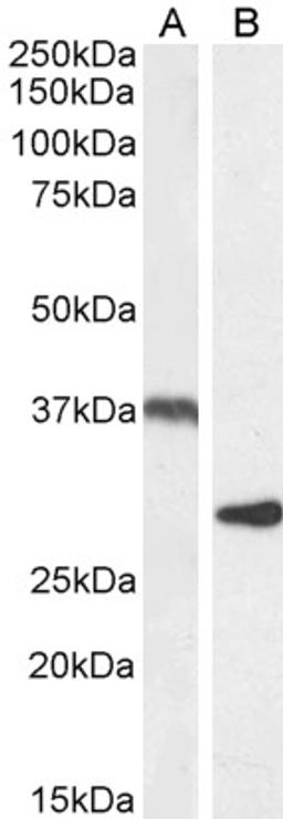 46-549 (1ug/ml) staining of Rat Adipose (A) and Mouse Spleen (B) lysate (35ug protein in RIPA buffer). Detected by chemiluminescence.