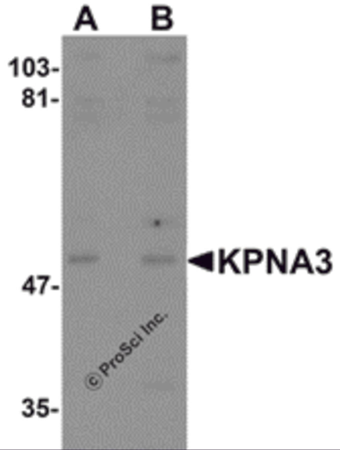 Western blot analysis of KPNA3 in EL4 cell lysate with KPNA3 antibody at (A) 1 and (B) 2 μg/mL.