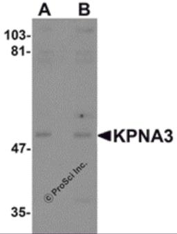 Western blot analysis of KPNA3 in EL4 cell lysate with KPNA3 antibody at (A) 1 and (B) 2 μg/mL.