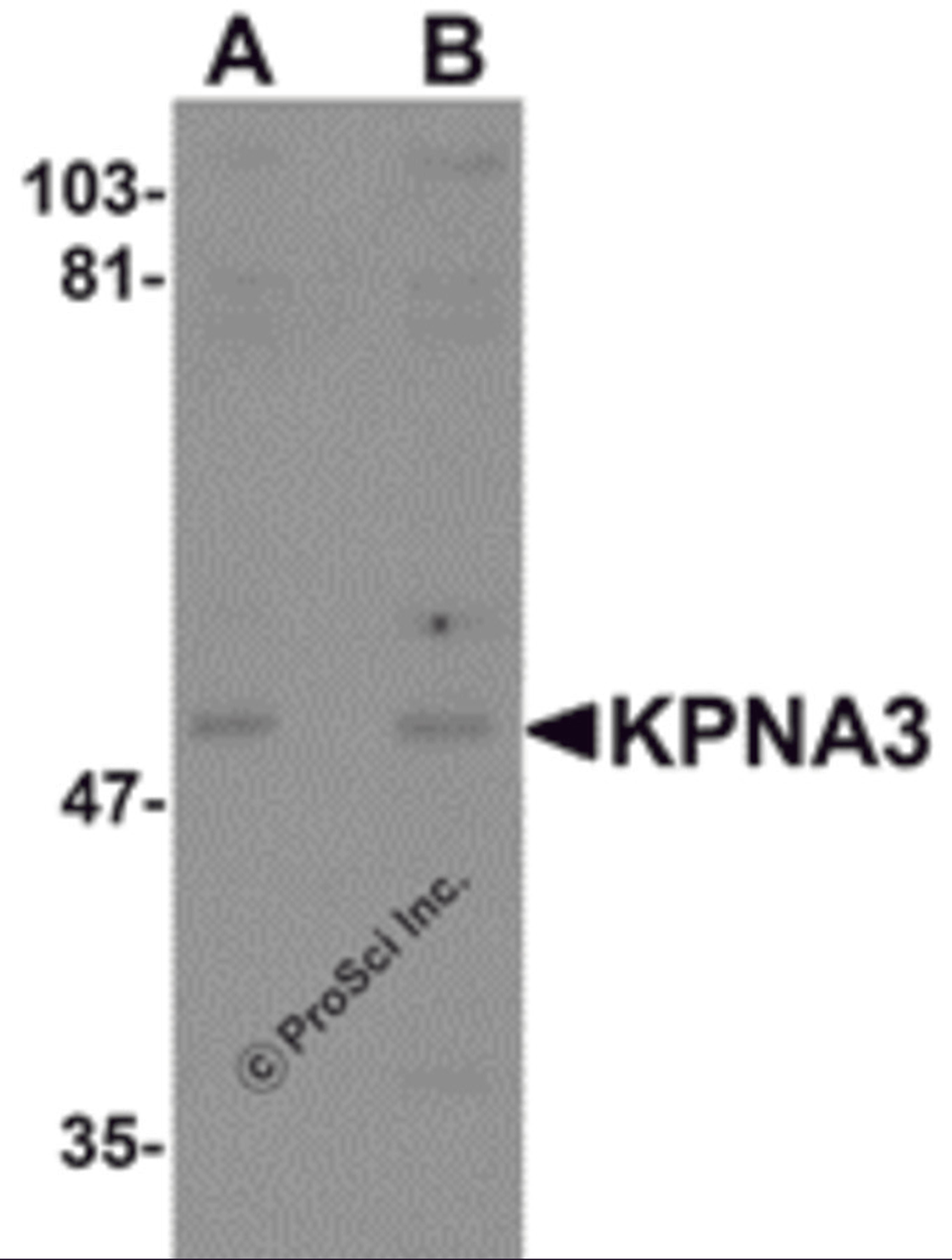 Western blot analysis of KPNA3 in EL4 cell lysate with KPNA3 antibody at (A) 1 and (B) 2 μg/mL.