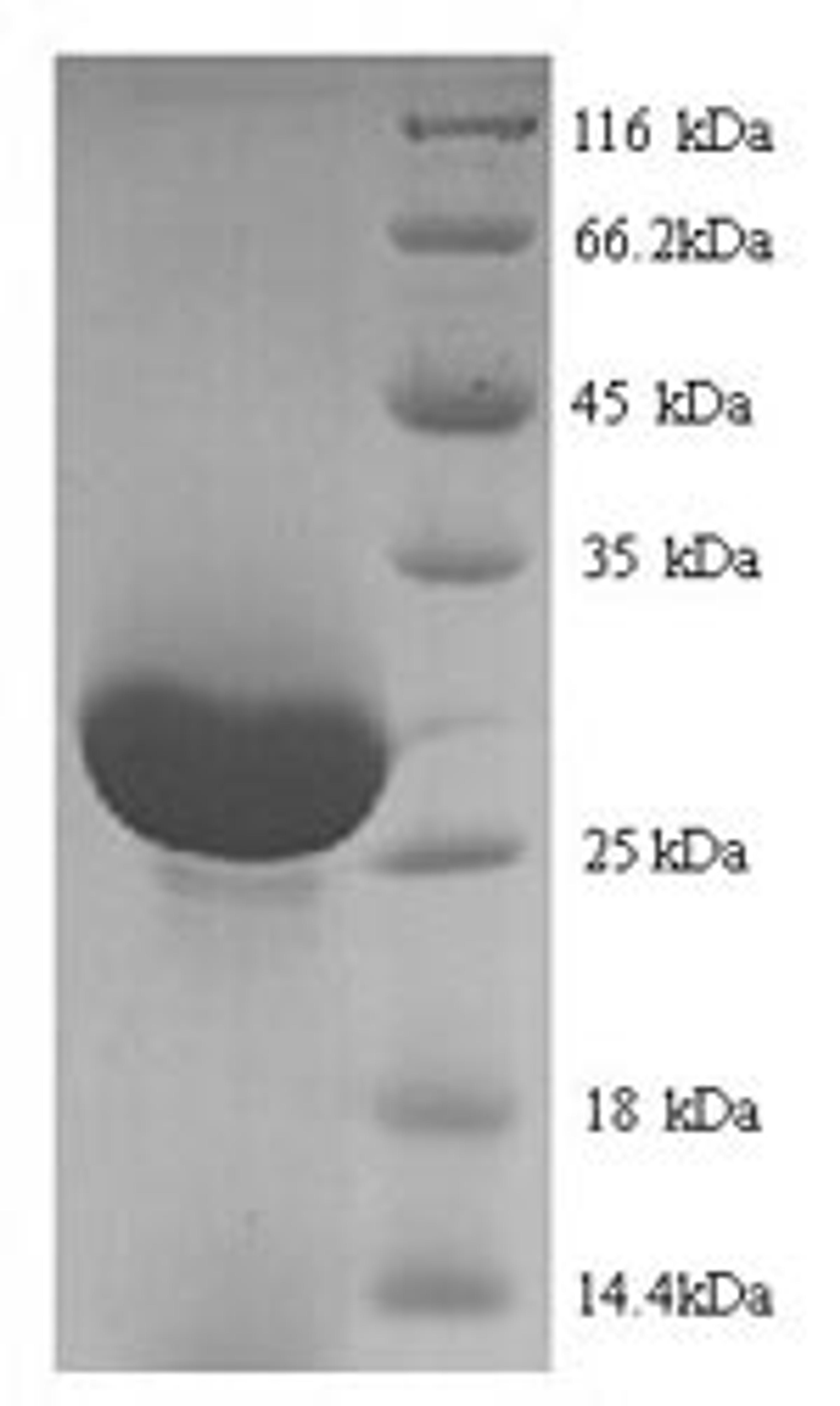 (Tris-Glycine gel) Discontinuous SDS-PAGE (reduced) with 5% enrichment gel and 15% separation gel.