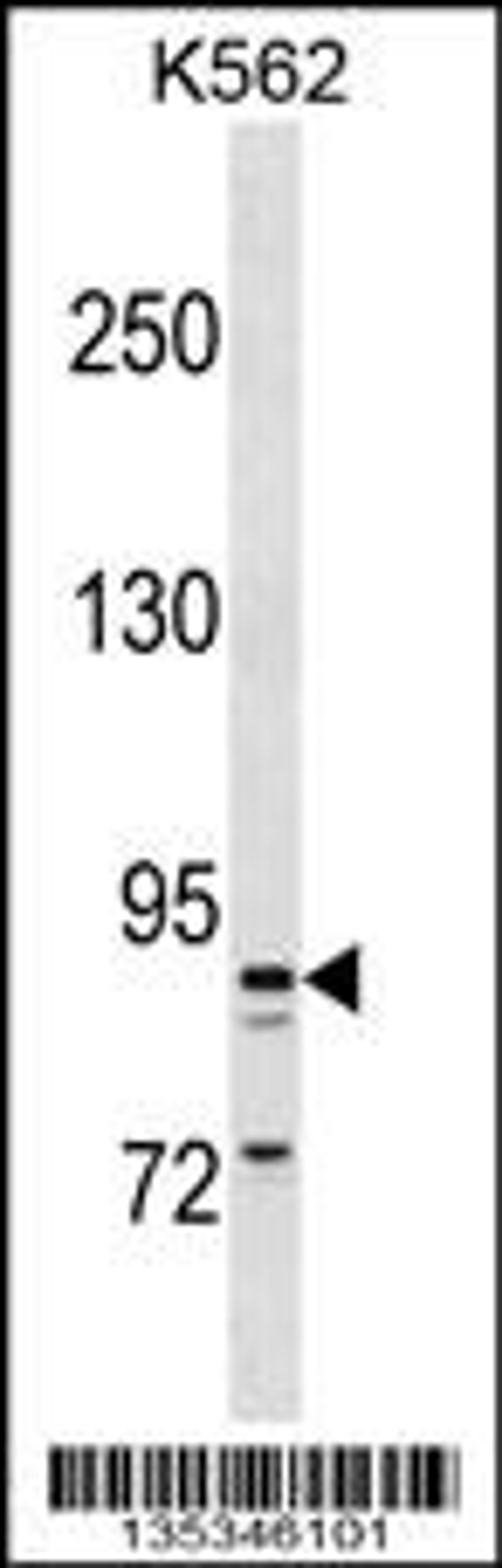 Western blot analysis in K562 cell line lysates (35ug/lane).