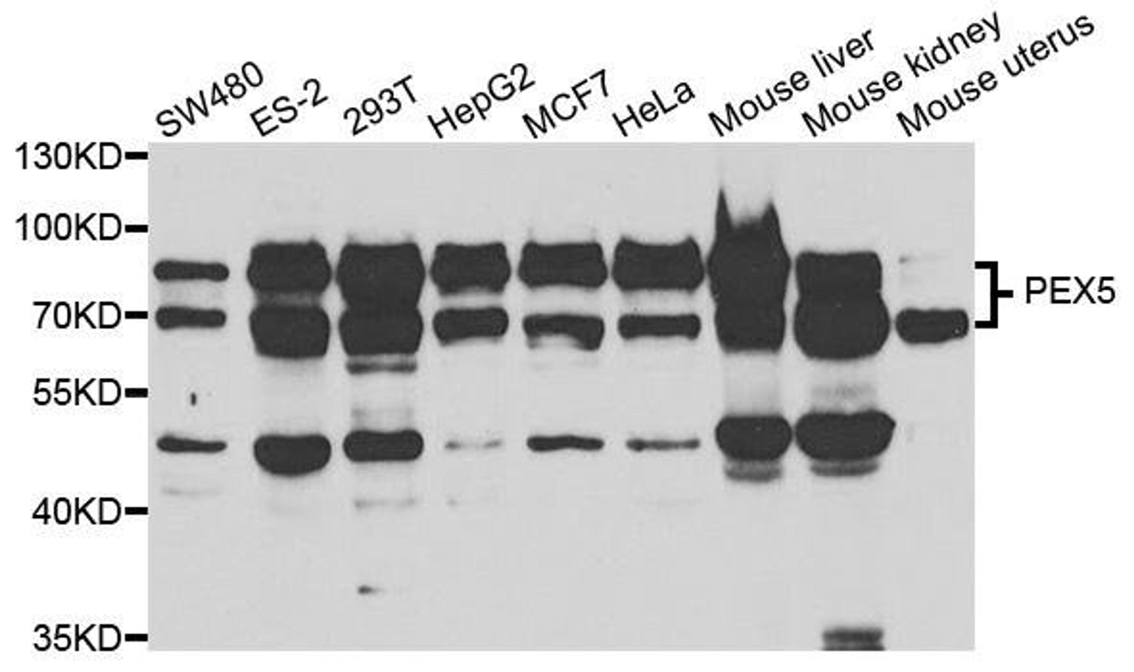 Western blot analysis of extracts of various cell lines using PEX5 antibody