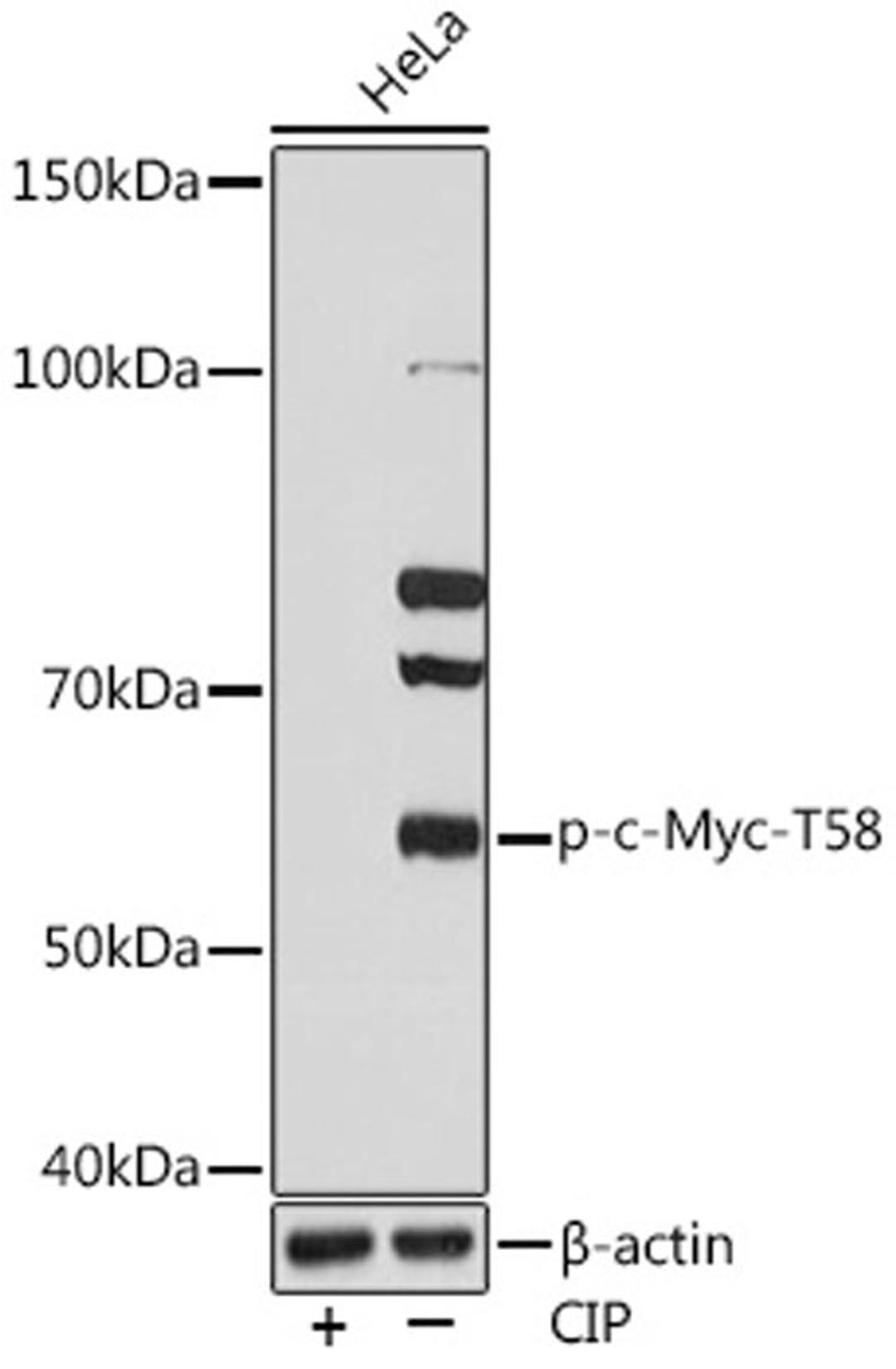 Western blot - Phospho-c-Myc-T58 Rabbit mAb (AP0990)