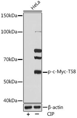 Western blot - Phospho-c-Myc-T58 Rabbit mAb (AP0990)