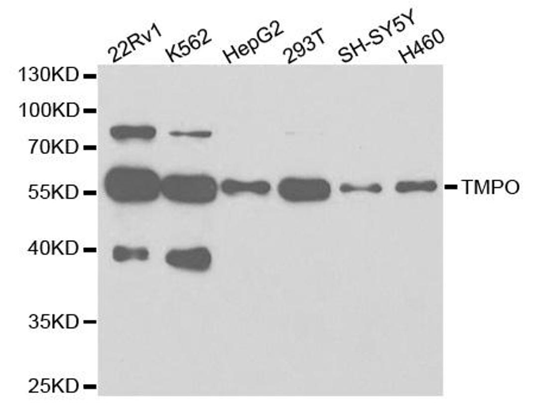 Western blot analysis of extracts of various cell lines using TMPO antibody