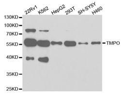 Western blot analysis of extracts of various cell lines using TMPO antibody