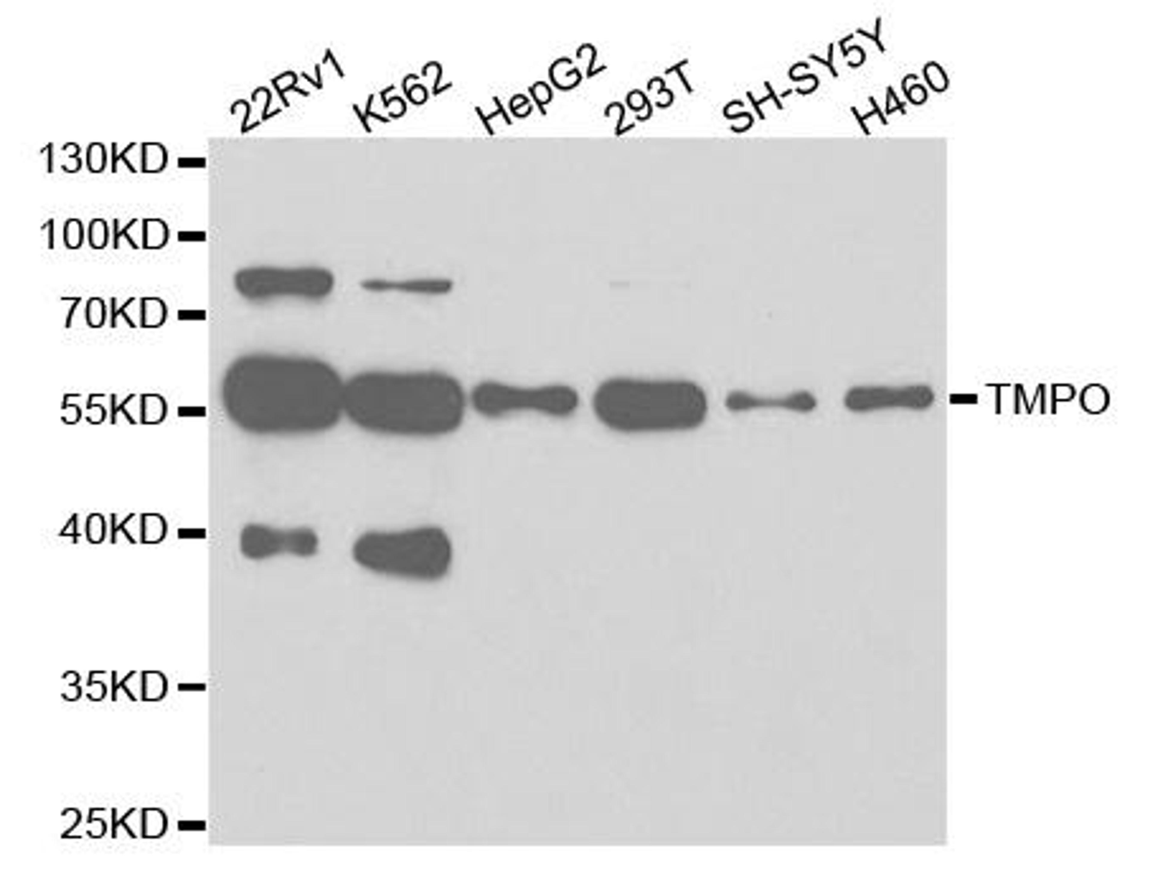 Western blot analysis of extracts of various cell lines using TMPO antibody