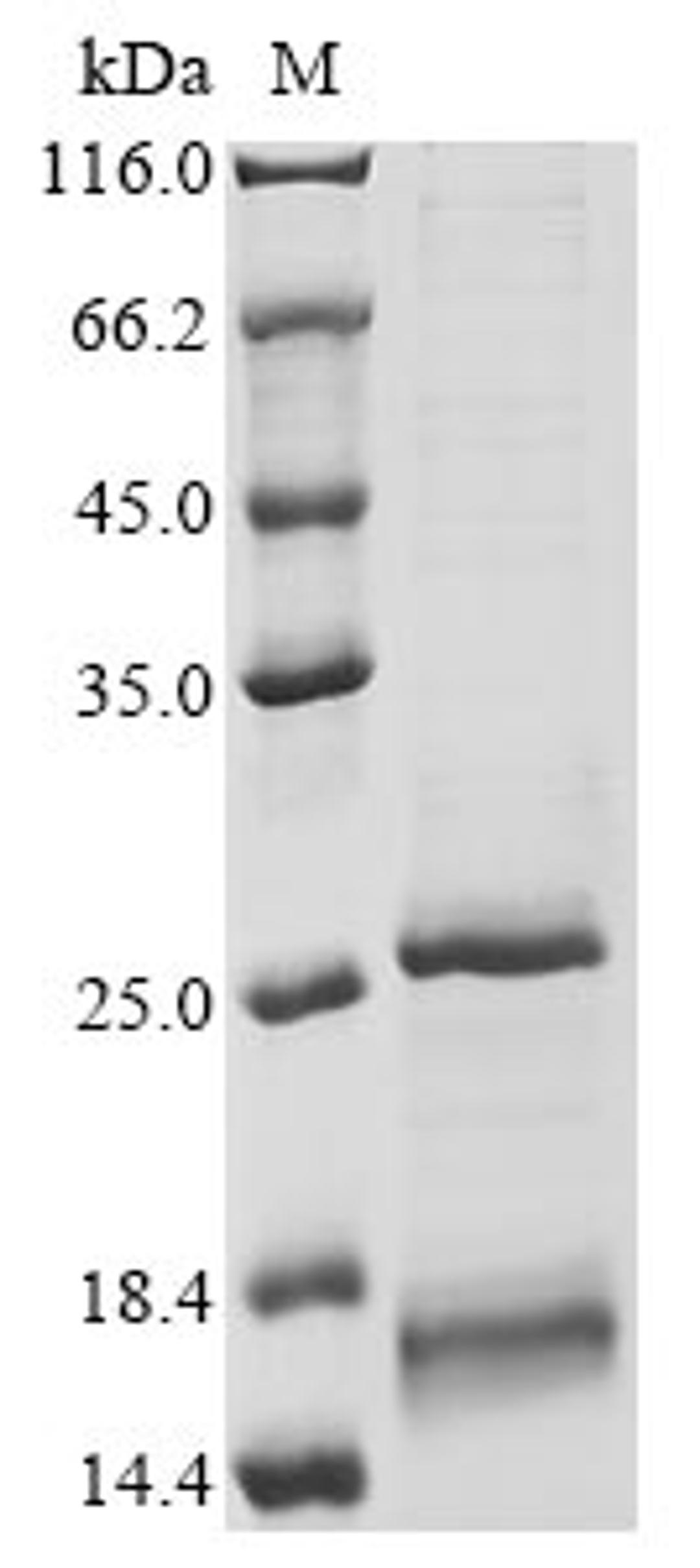 (Tris-Glycine gel) Discontinuous SDS-PAGE (reduced) with 5% enrichment gel and 15% separation gel.