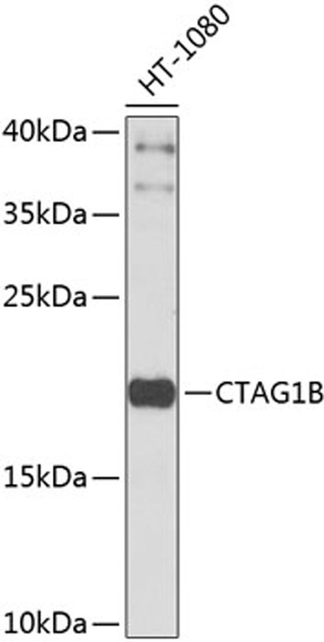 Western blot - CTAG1B antibody (A9810)