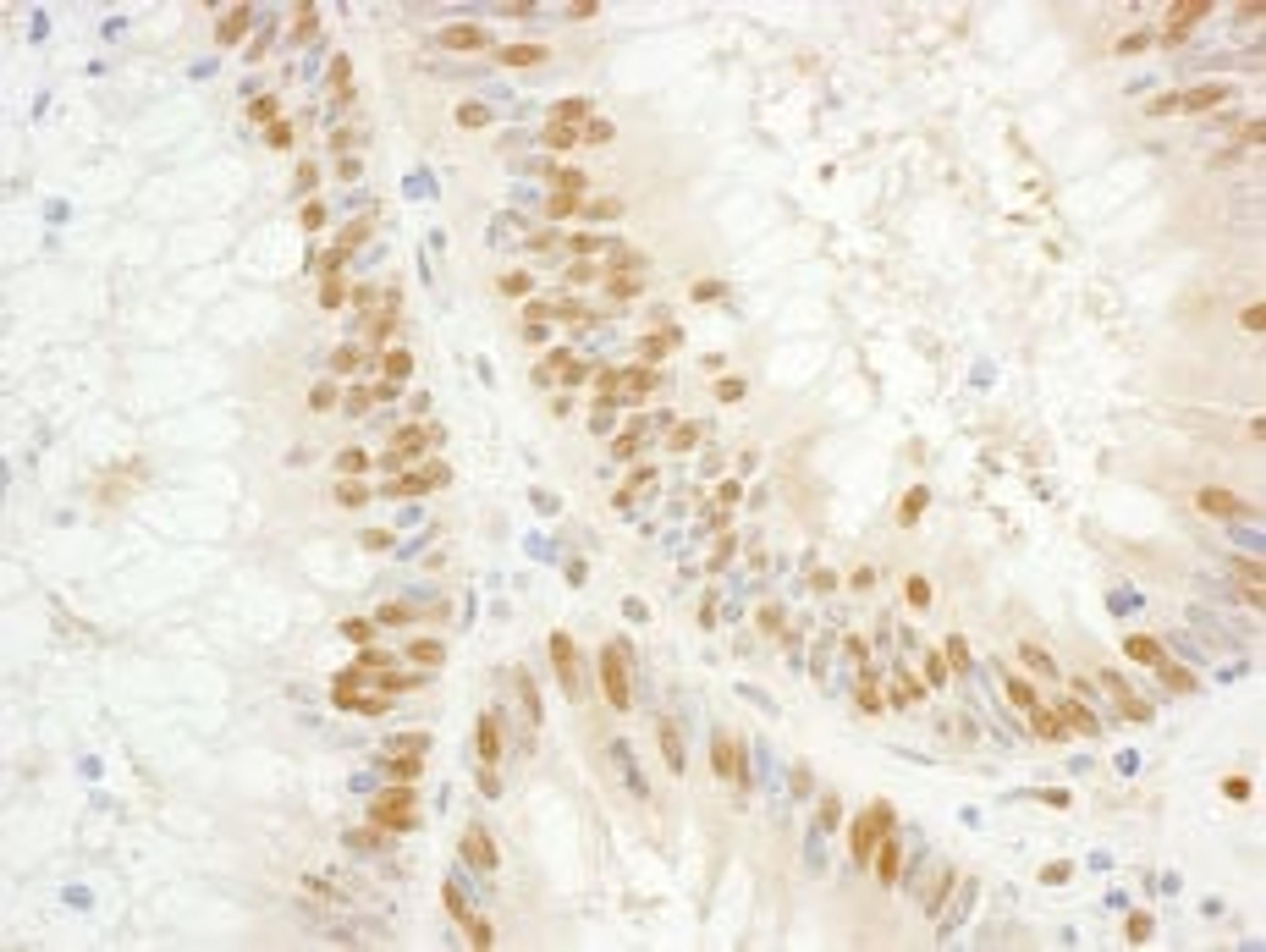 Detection of human GTF2E1/TFIIE-alpha by immunohistochemistry.