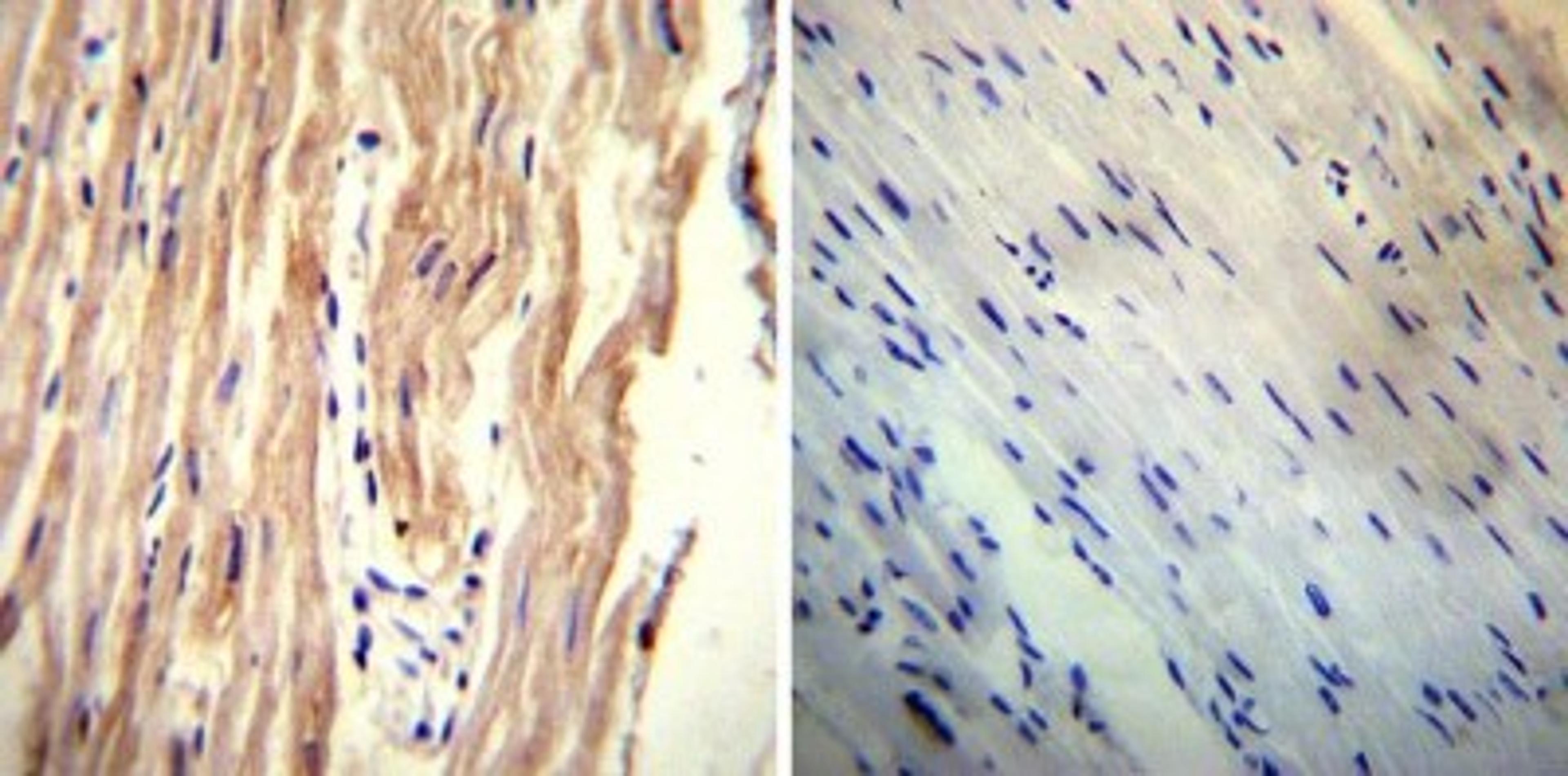 Immunohistochemistry-Paraffin: Sodium-Calcium Exchanger Antibody (C2C12) [NB120-2869] - Both normal and cancer biopsies of deparaffinized Human heart tissue tissues.