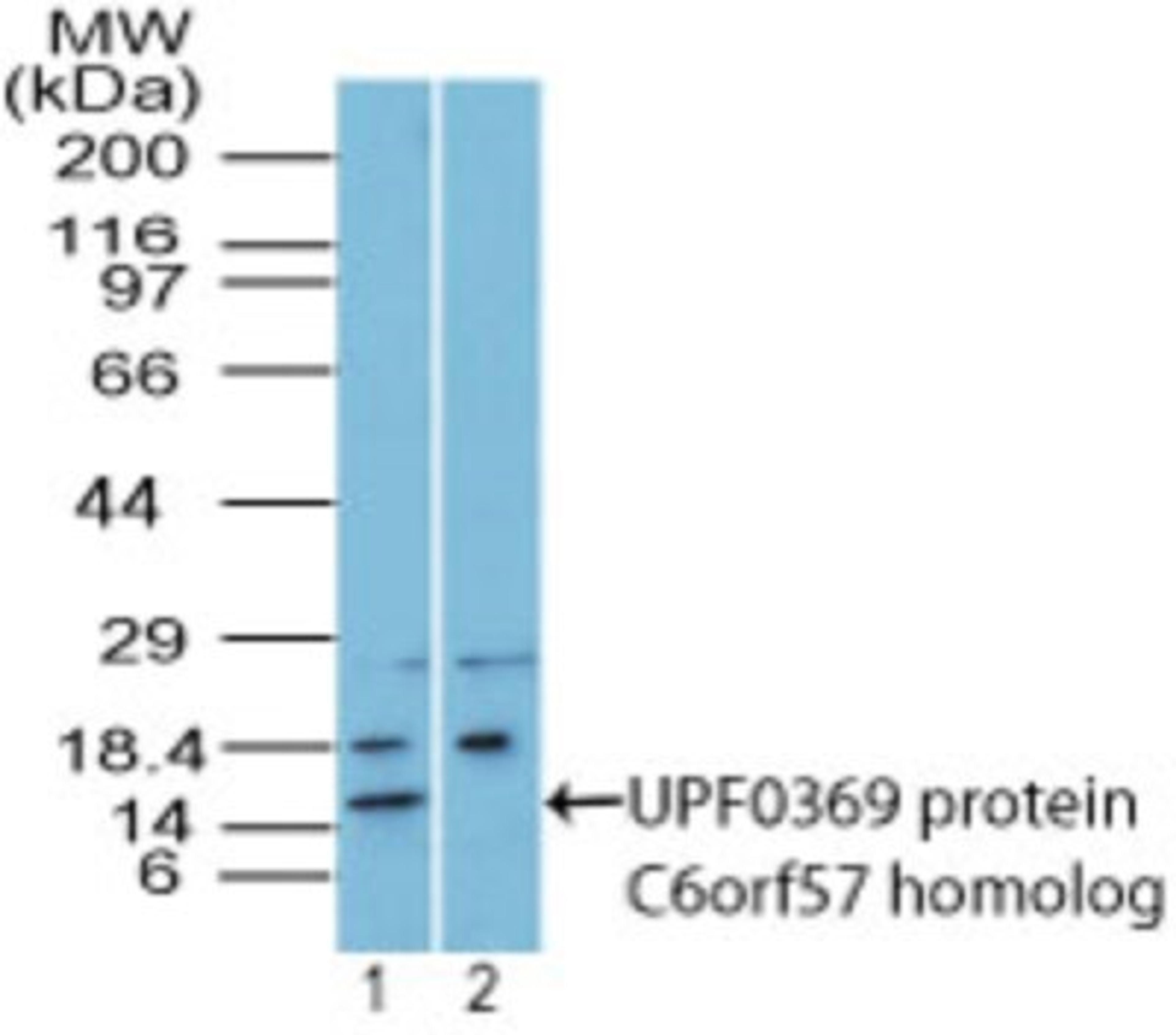 Western Blot: C6orf57 Antibody [NBP2-27170] - analysis of UPF0369 protein C6orf57 homolog in mouse embryo body tissue lysates in the 1) absence and 2) presence of immunizing peptide using this antibody. I goat anti-rabbit Ig HRP secondary antibody and PicoTect ECL substrate solution were used for this test.