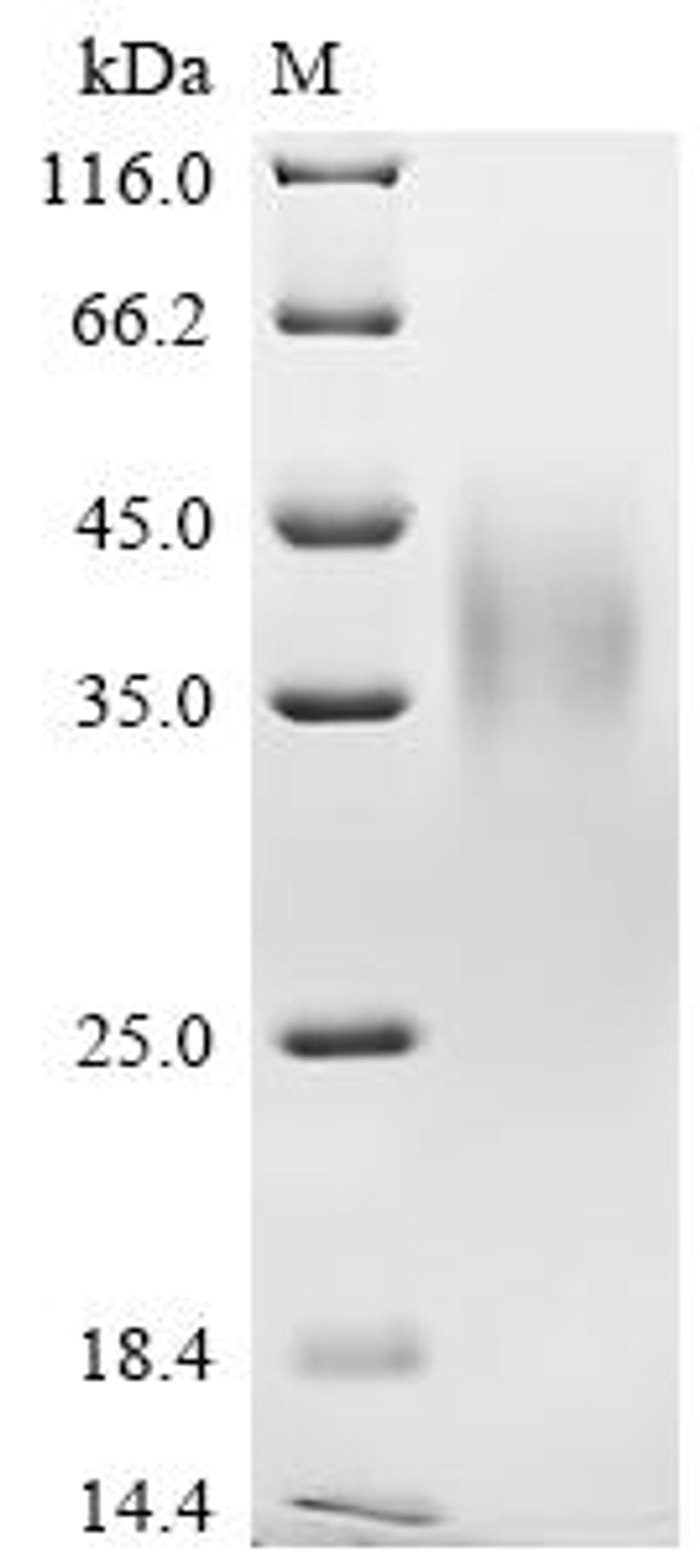 (Tris-Glycine gel) Discontinuous SDS-PAGE (reduced) with 5% enrichment gel and 15% separation gel.