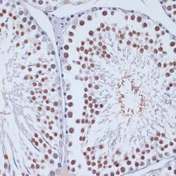 Immunohistochemistry - DNMT3L antibody (A2342)