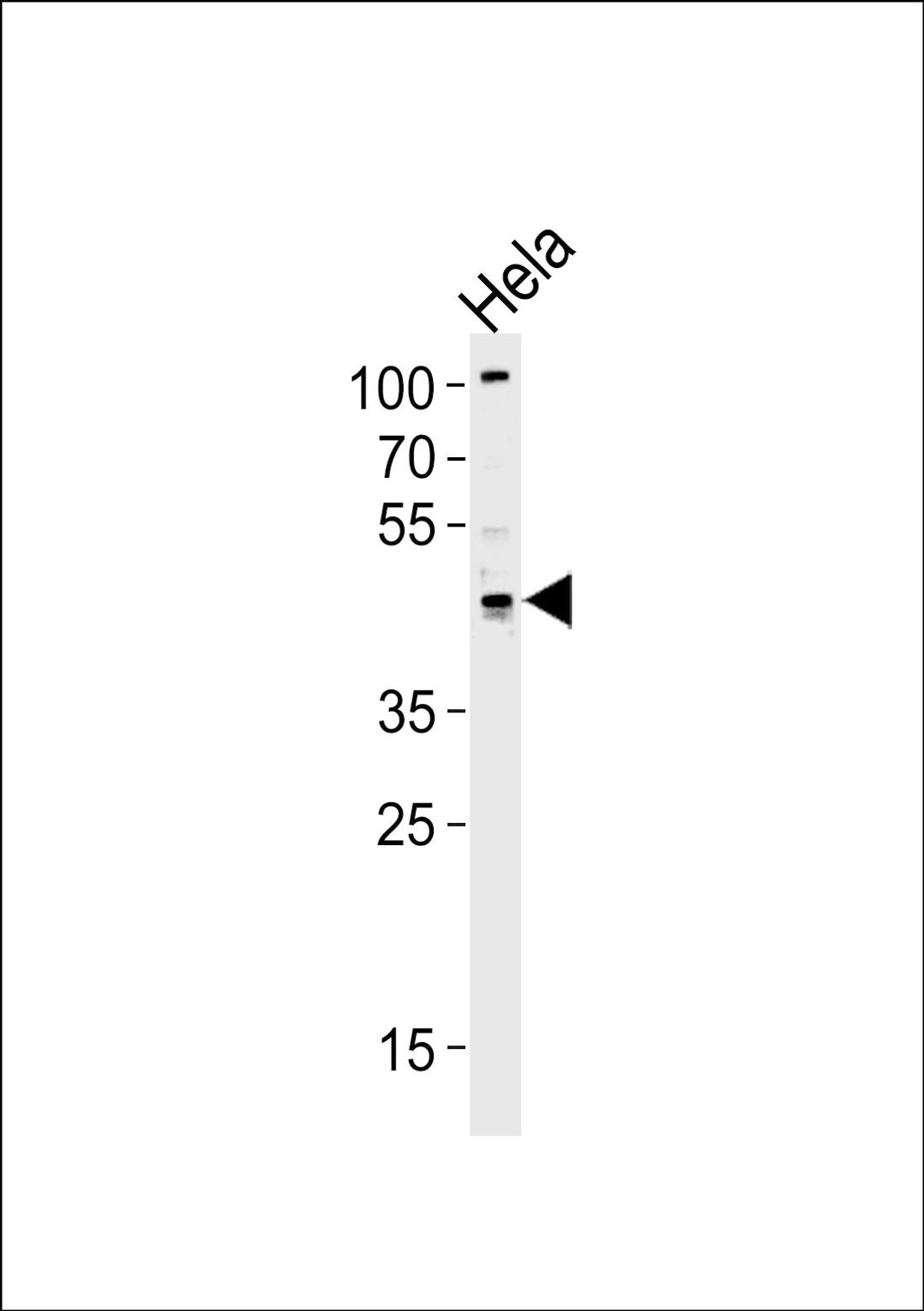 Western blot analysis of lysate from Hela cell line, using TRIP13 Antibody at 1:1000 at each lane.