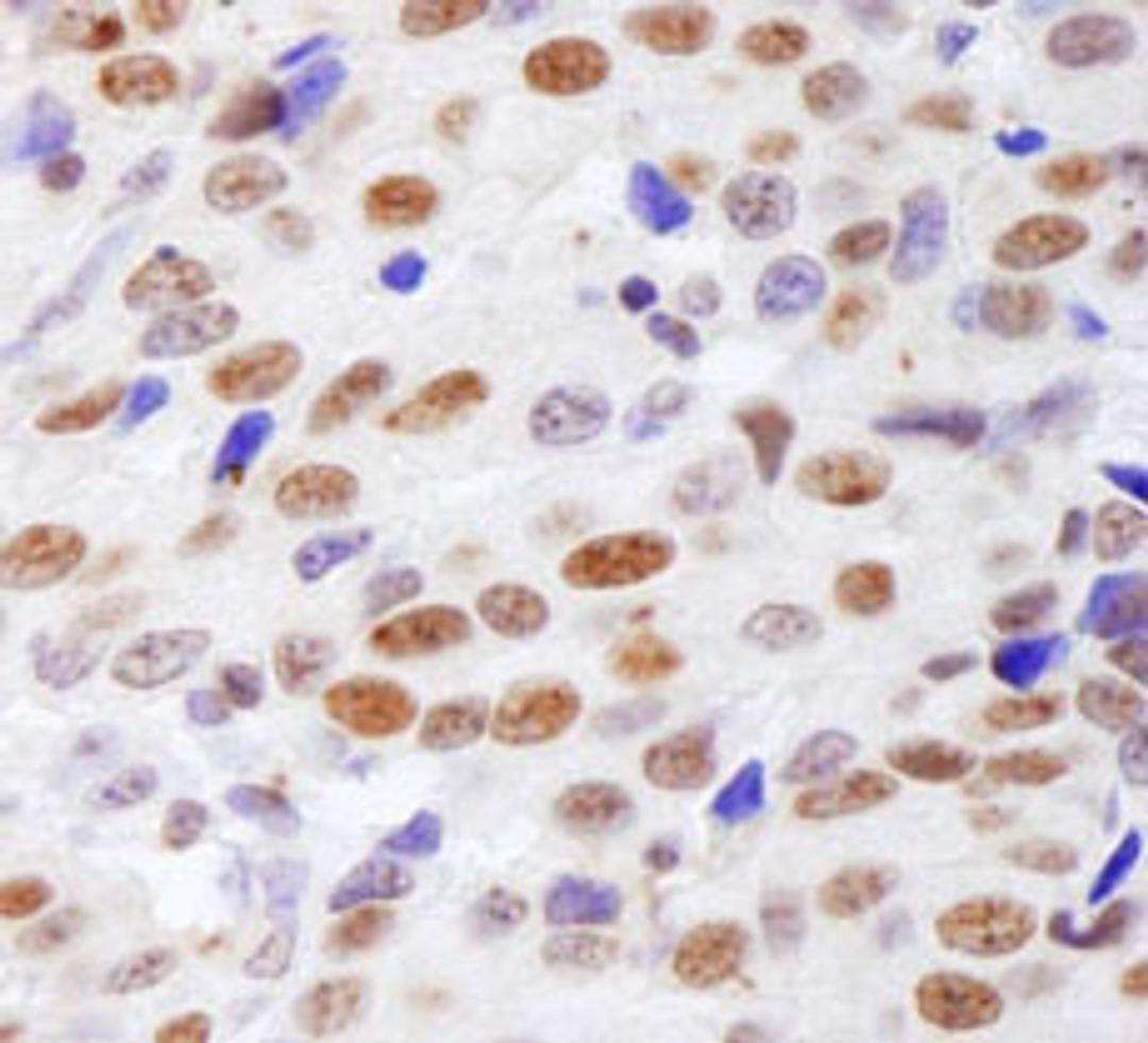 Detection of human Histone H4 by immunohistochemistry.