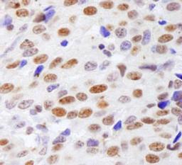 Detection of human Histone H4 by immunohistochemistry.