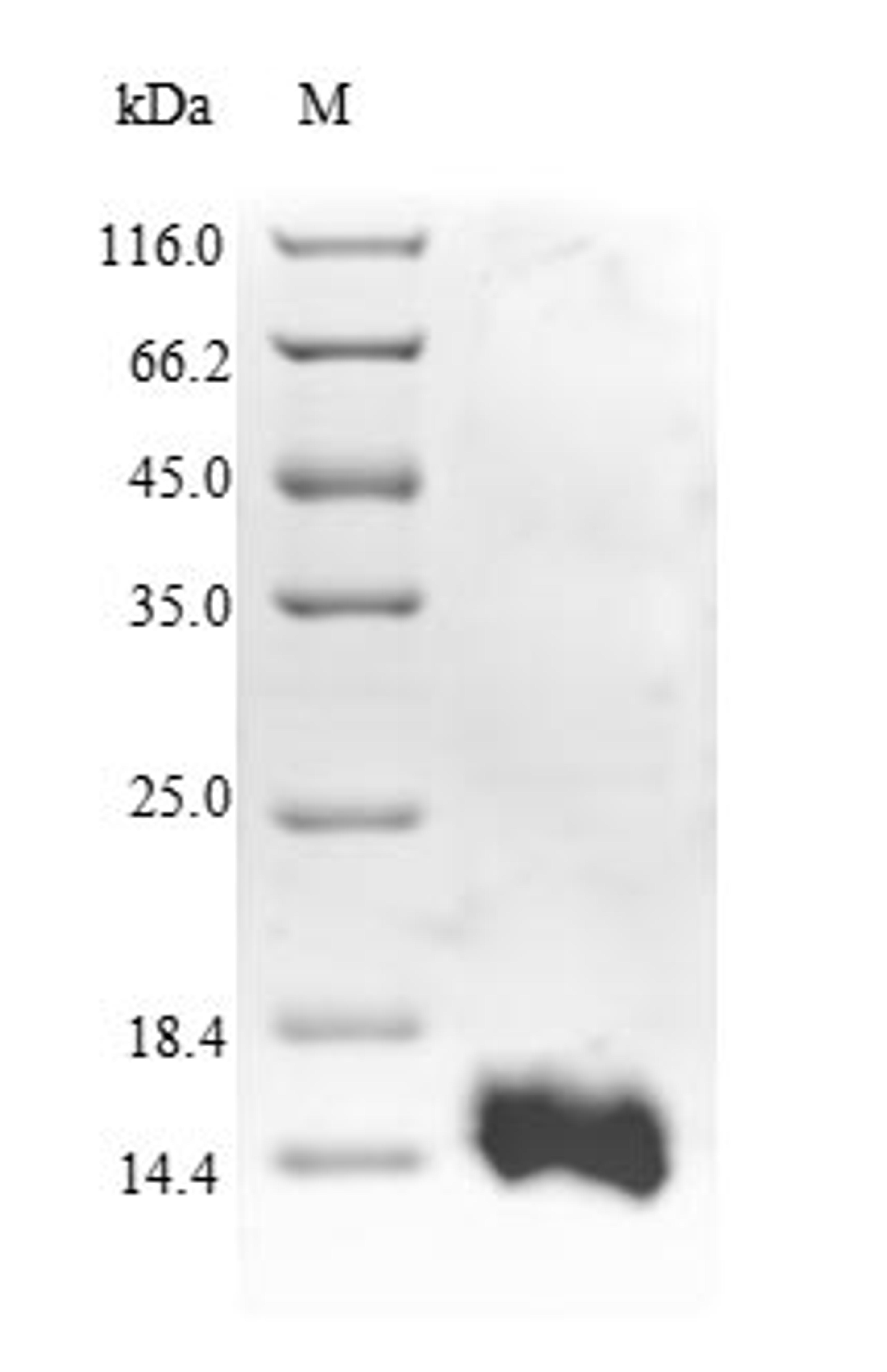 (Tris-Glycine gel) Discontinuous SDS-PAGE (reduced) with 5% enrichment gel and 15% separation gel.