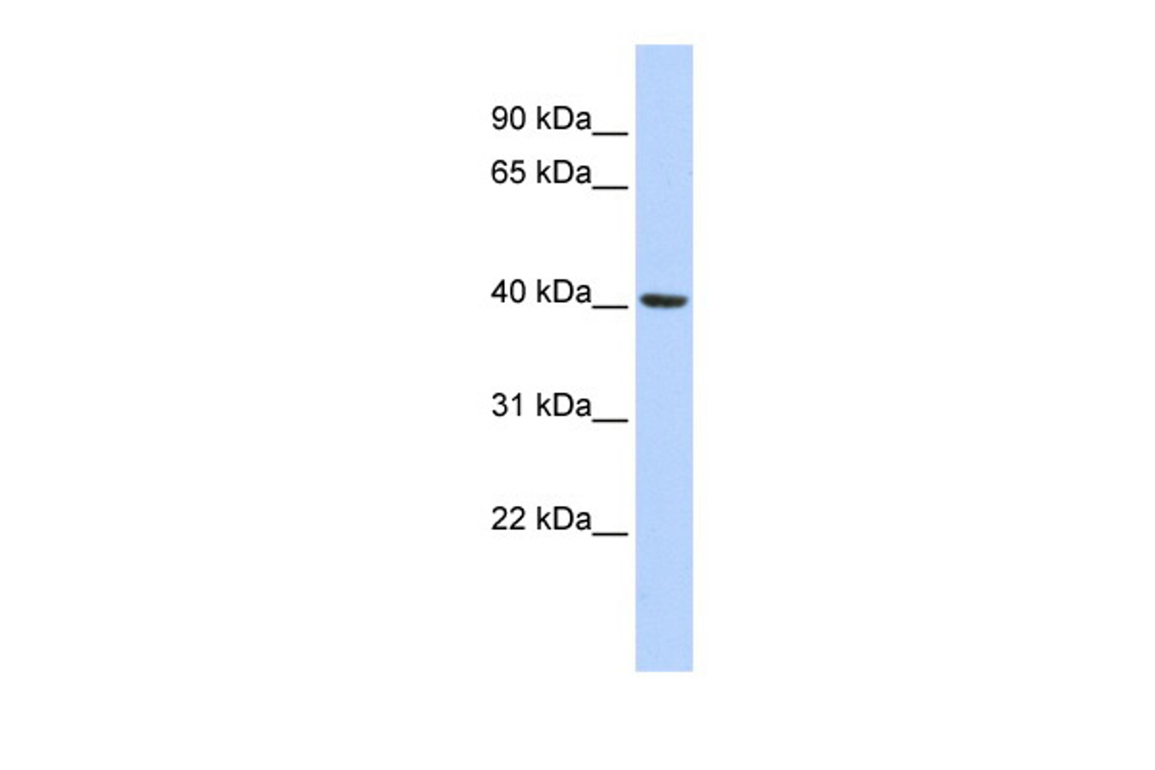 Antibody used in WB on Human Lung at 0.2-1 ug/ml.