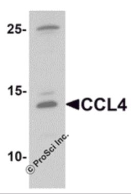 Western blot analysis of CCL4 in rat brain tissue lysate with CCL4 antibody at 1 &#956;g/mL.