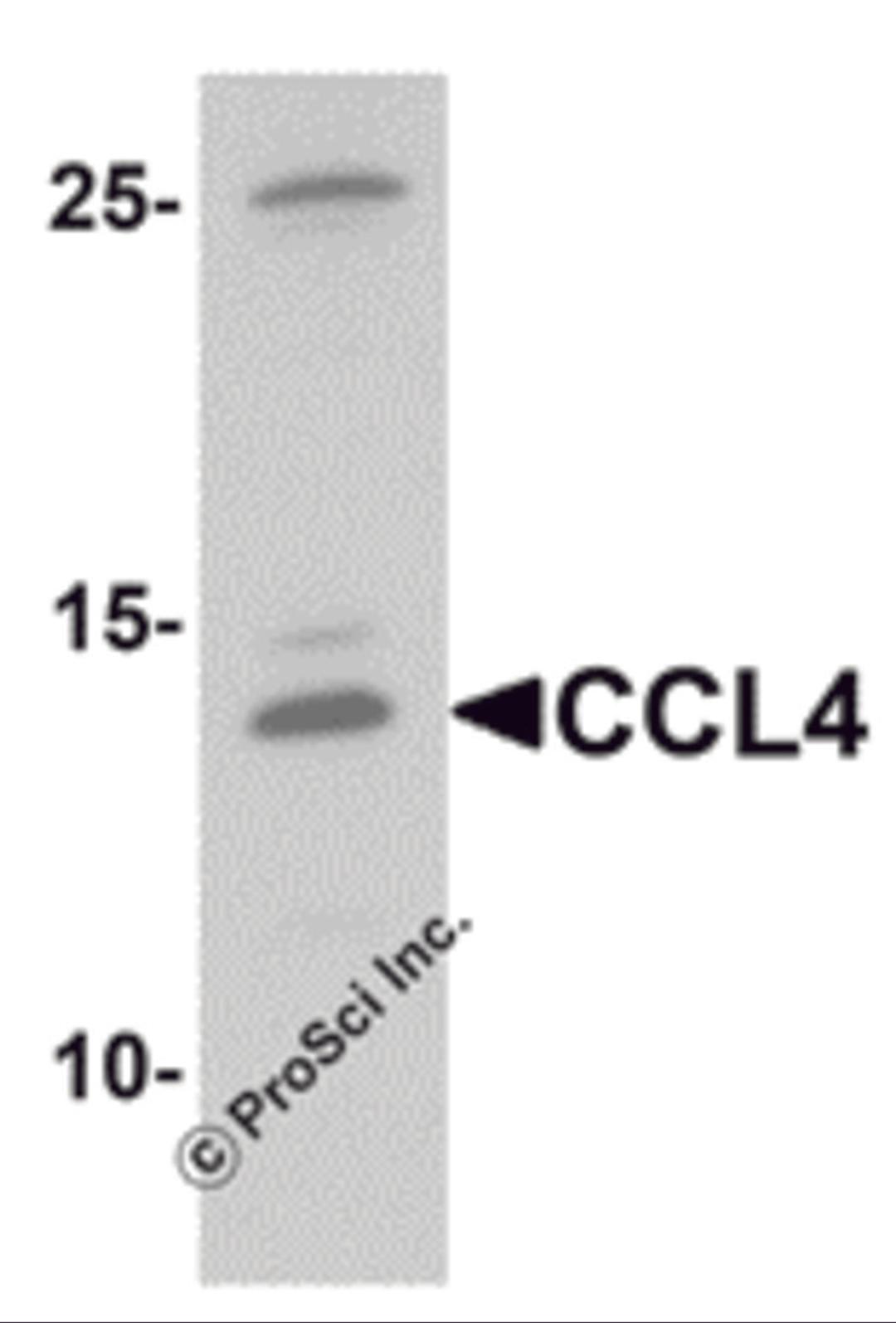 Western blot analysis of CCL4 in rat brain tissue lysate with CCL4 antibody at 1 μg/mL.