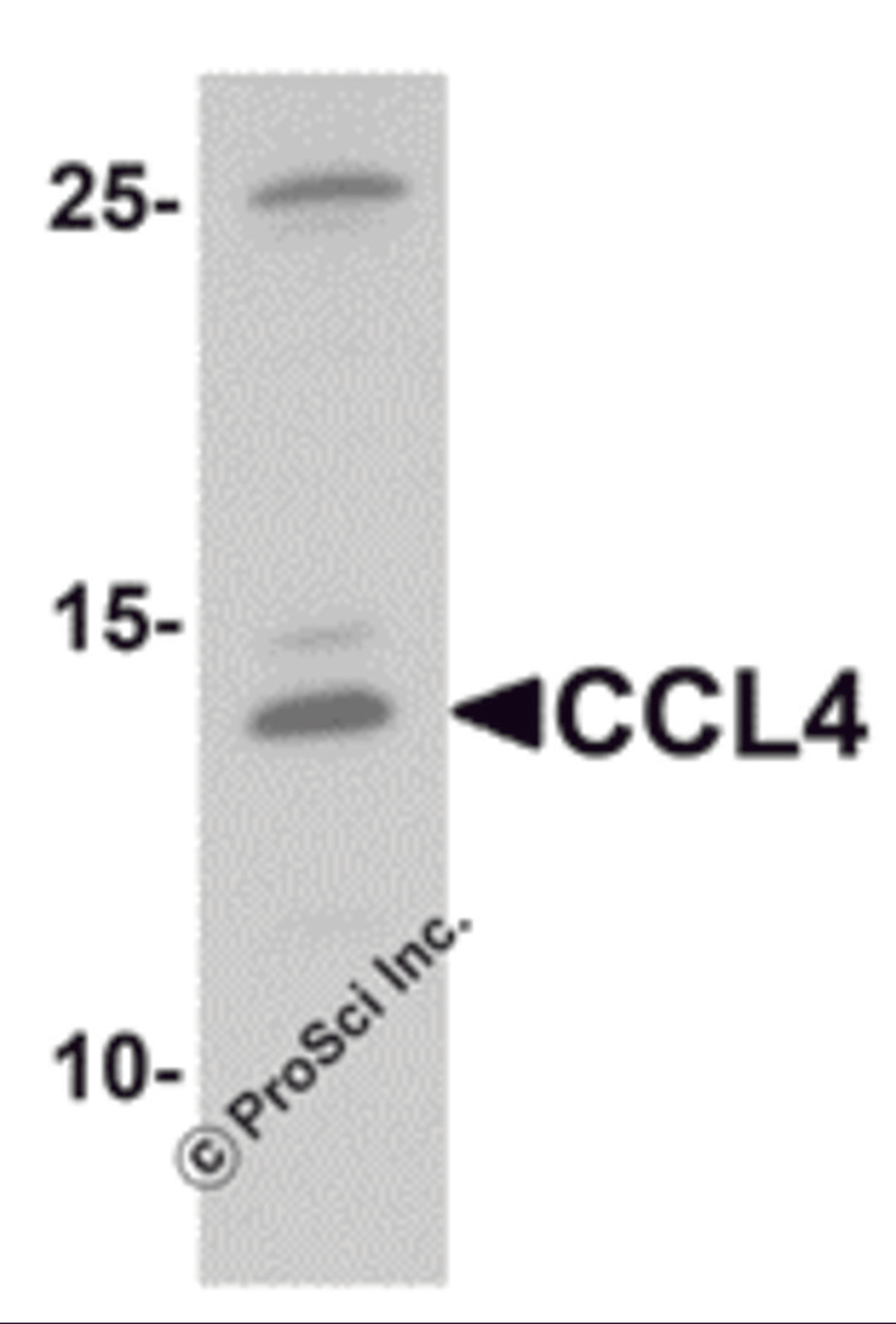 Western blot analysis of CCL4 in rat brain tissue lysate with CCL4 antibody at 1 μg/mL.