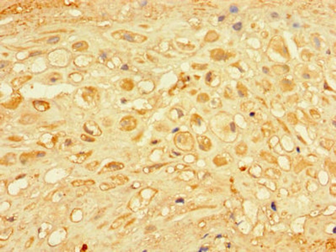 Immunohistochemistry of paraffin-embedded human placenta tissue using CSB-PA005356LA01HU at dilution of 1:100