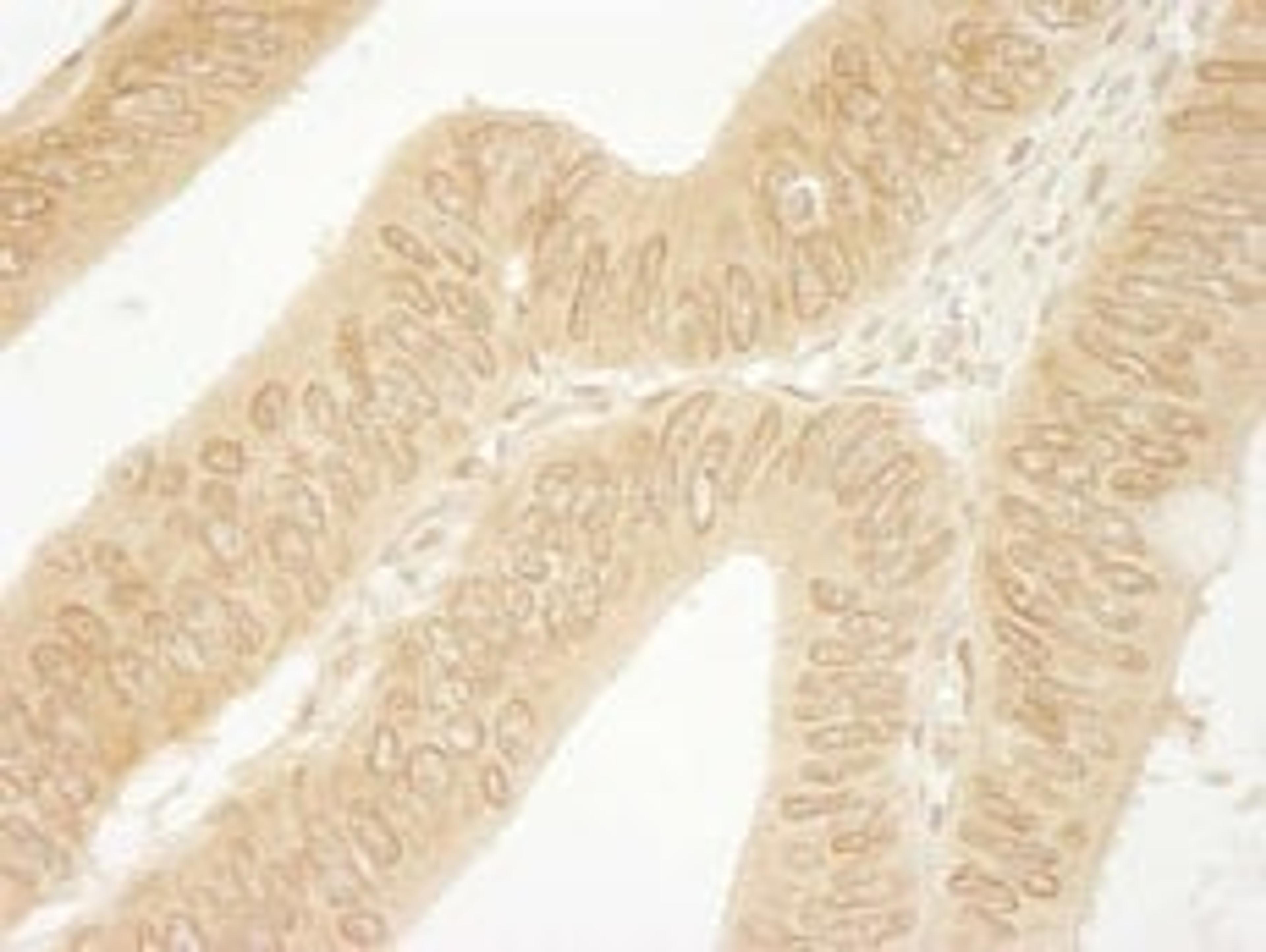 Detection of human CTNND1 immunohistochemistry.