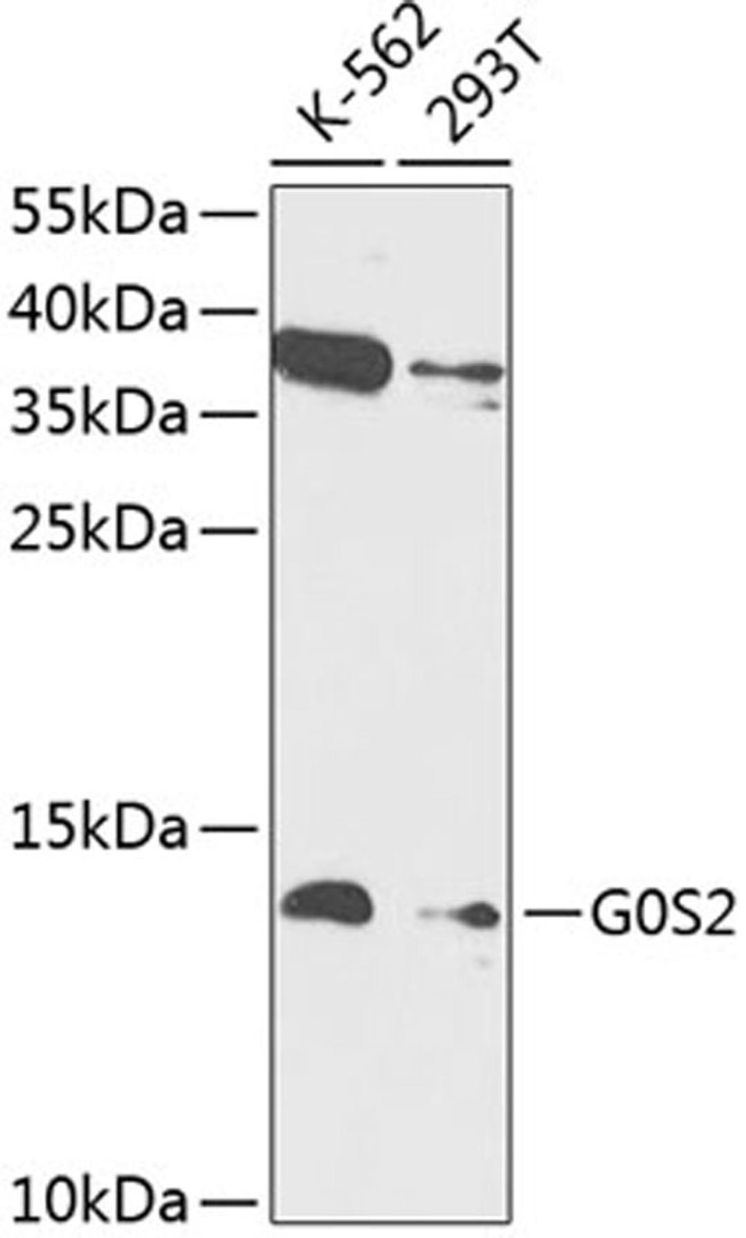 Western blot - G0S2 antibody (A14125)