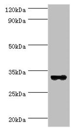 Western blot. All lanes: STX11 antibody at 6ug/ml + Mouse skeletal muscle tissue. Secondary. Goat polyclonal to rabbit IgG at 1/10000 dilution. Predicted band size: 33 kDa. Observed band size: 33 kDa. 