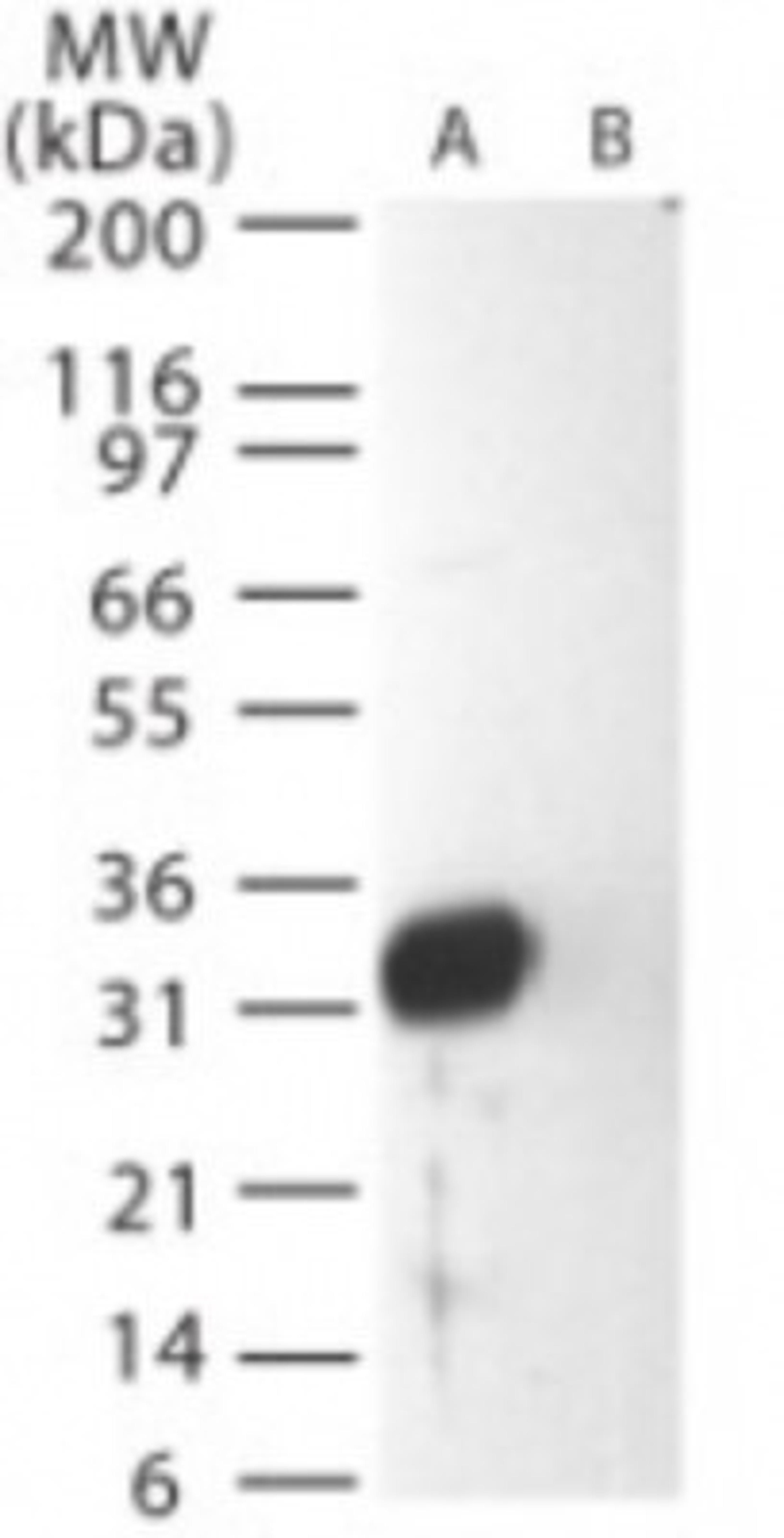 Western Blot: Sars Membrane Protein Antibody [NB100-56569] - Western blot analysis of Sars Membrane Protein in (A) recombinant fusion protein containing amino acids 195-210 and (B) fusion partner without these amino acids, using NB100-56569 at 0.5 ug/ml.