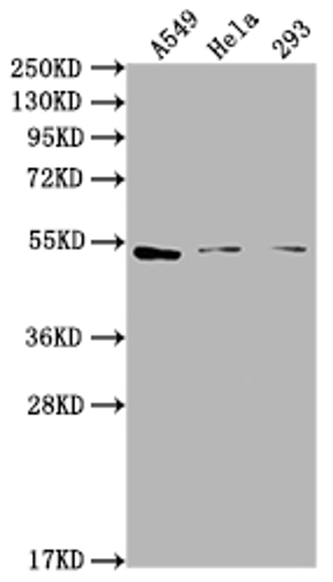 Western Blot. Positive WB detected in: A549 whole cell lysate, Hela whole cell lysate, 293 whole cell lysate. All lanes: CNR1 antibody at 1:2000. Secondary. Goat polyclonal to rabbit IgG at 1/50000 dilution. Predicted band size: 53, 46, 50 kDa. Observed band size: 53 kDa.